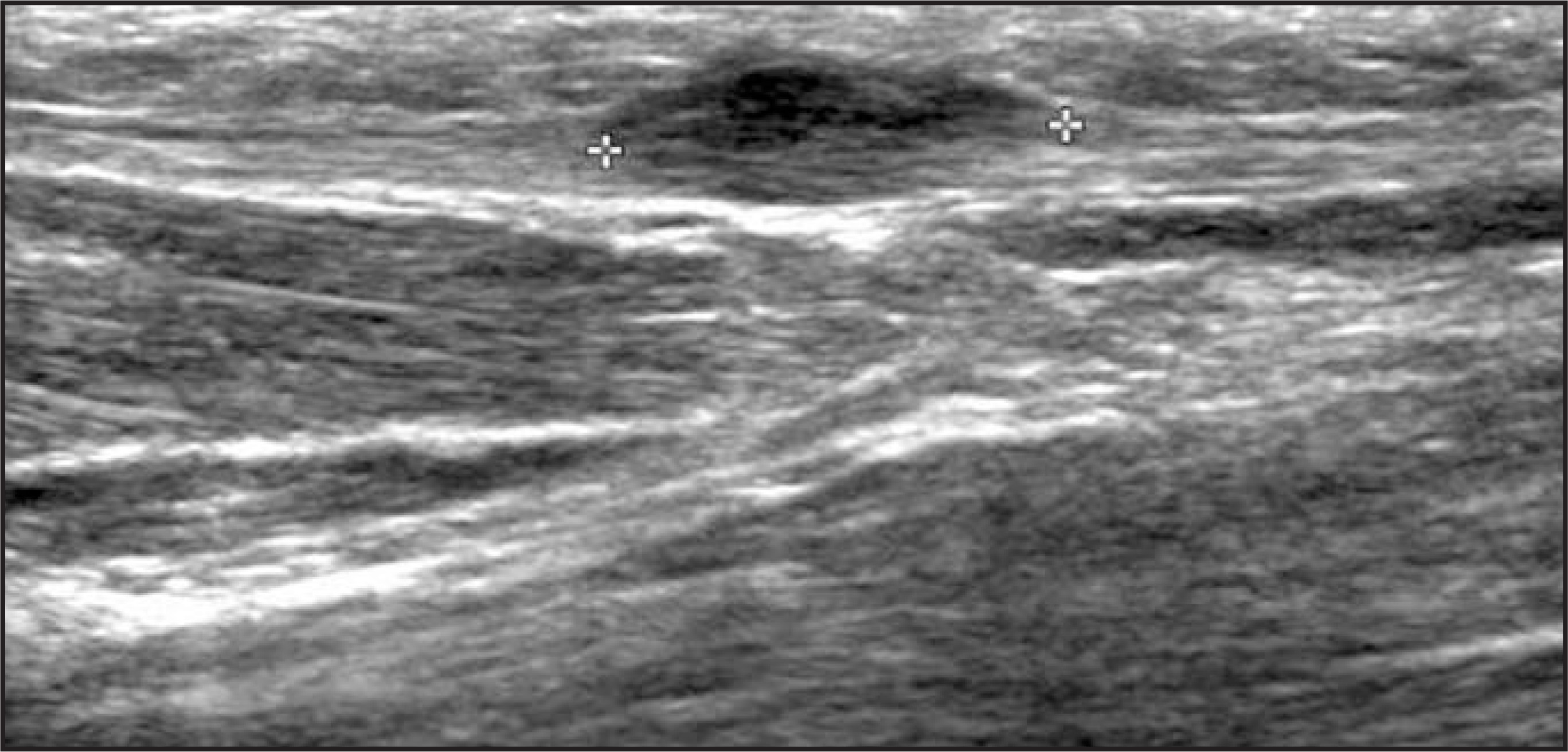 FIGURE 10.