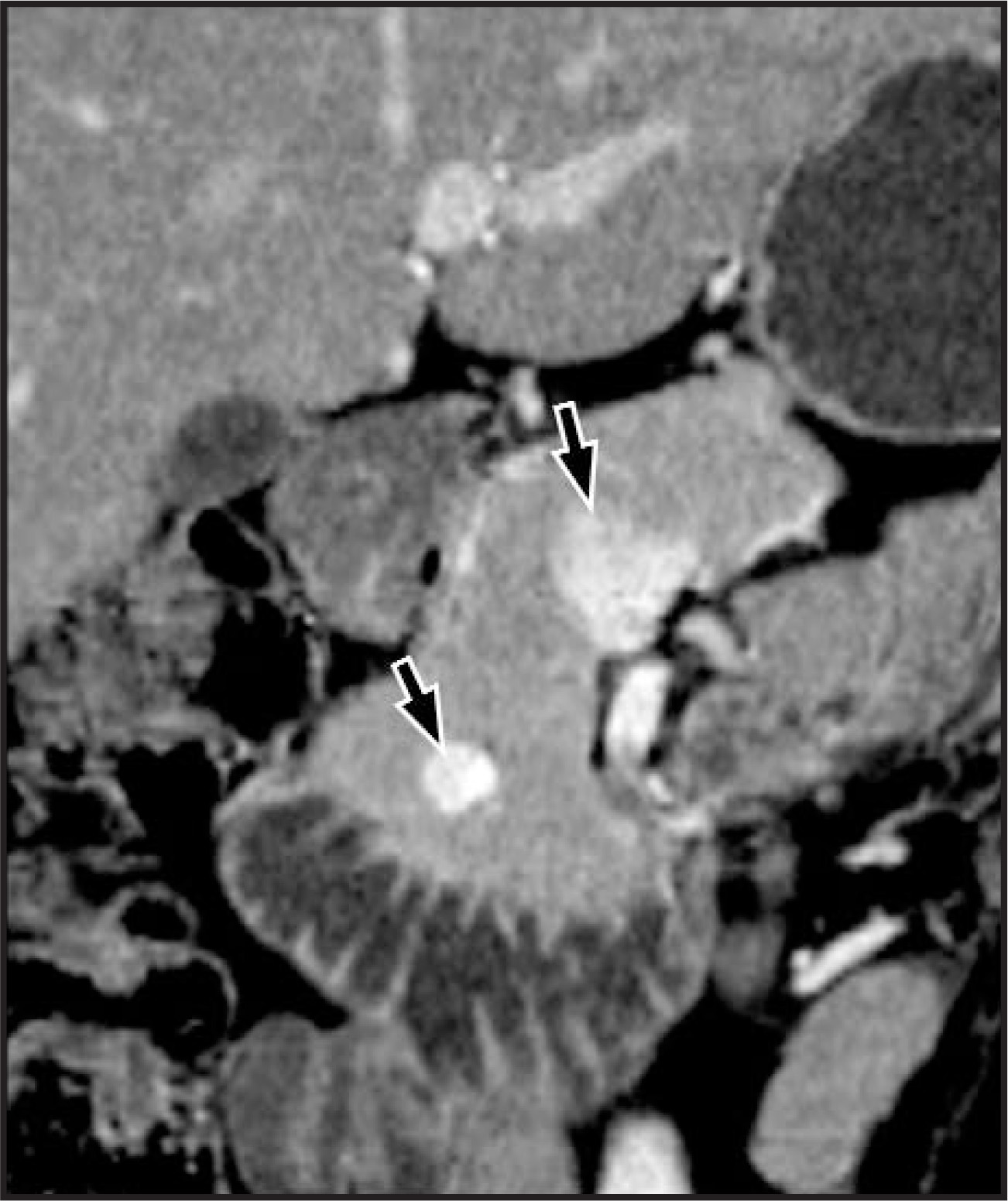FIGURE 11.
