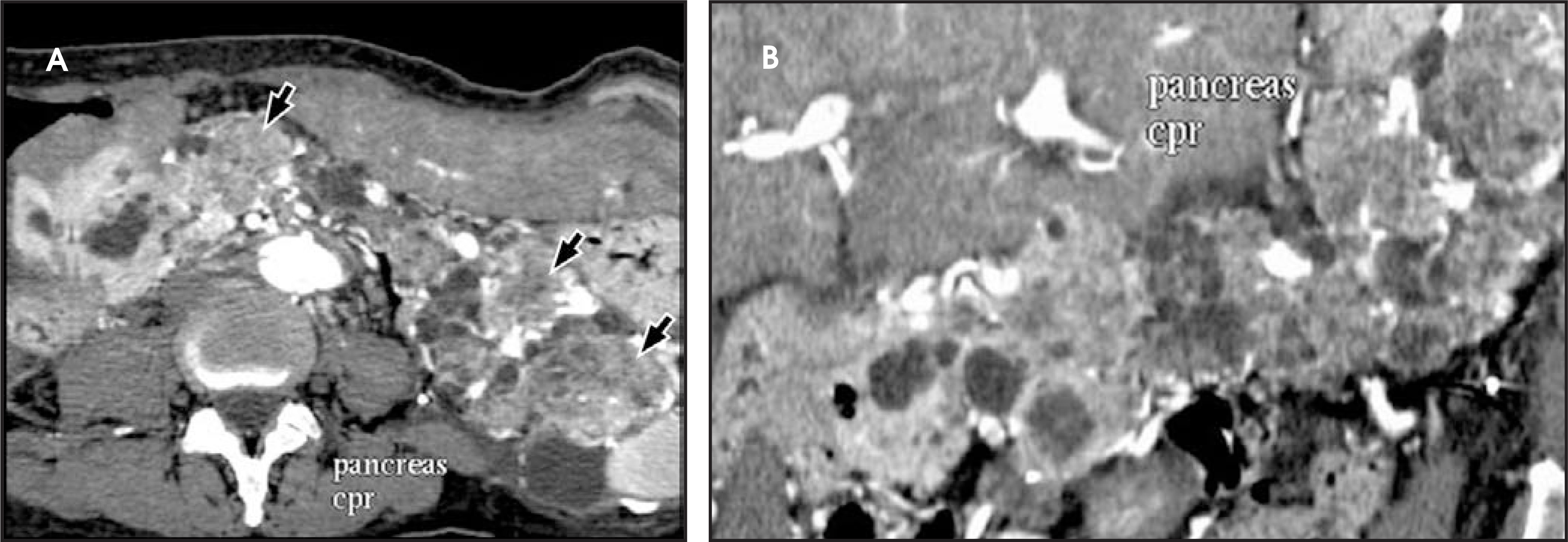 FIGURE 13.