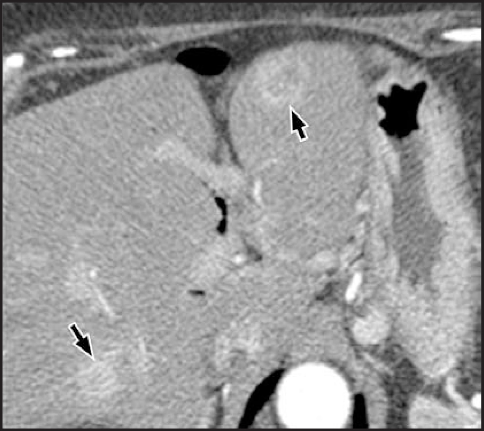 FIGURE 14.