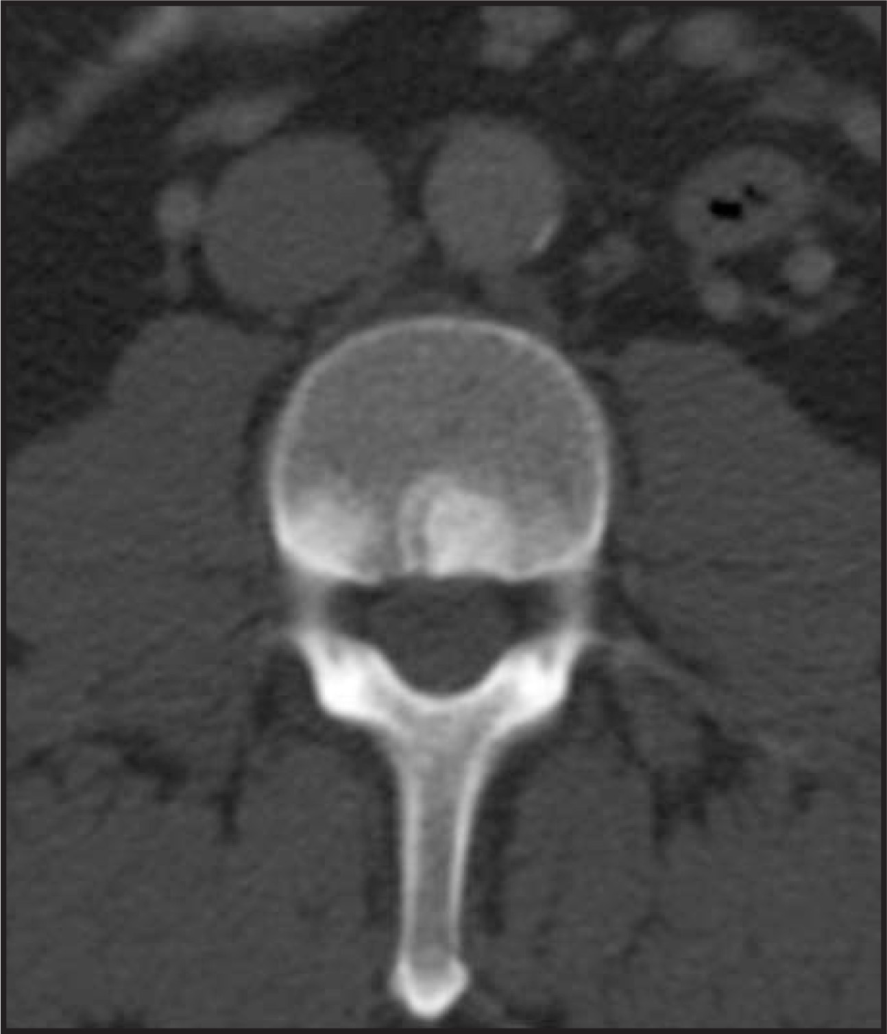 FIGURE 17.