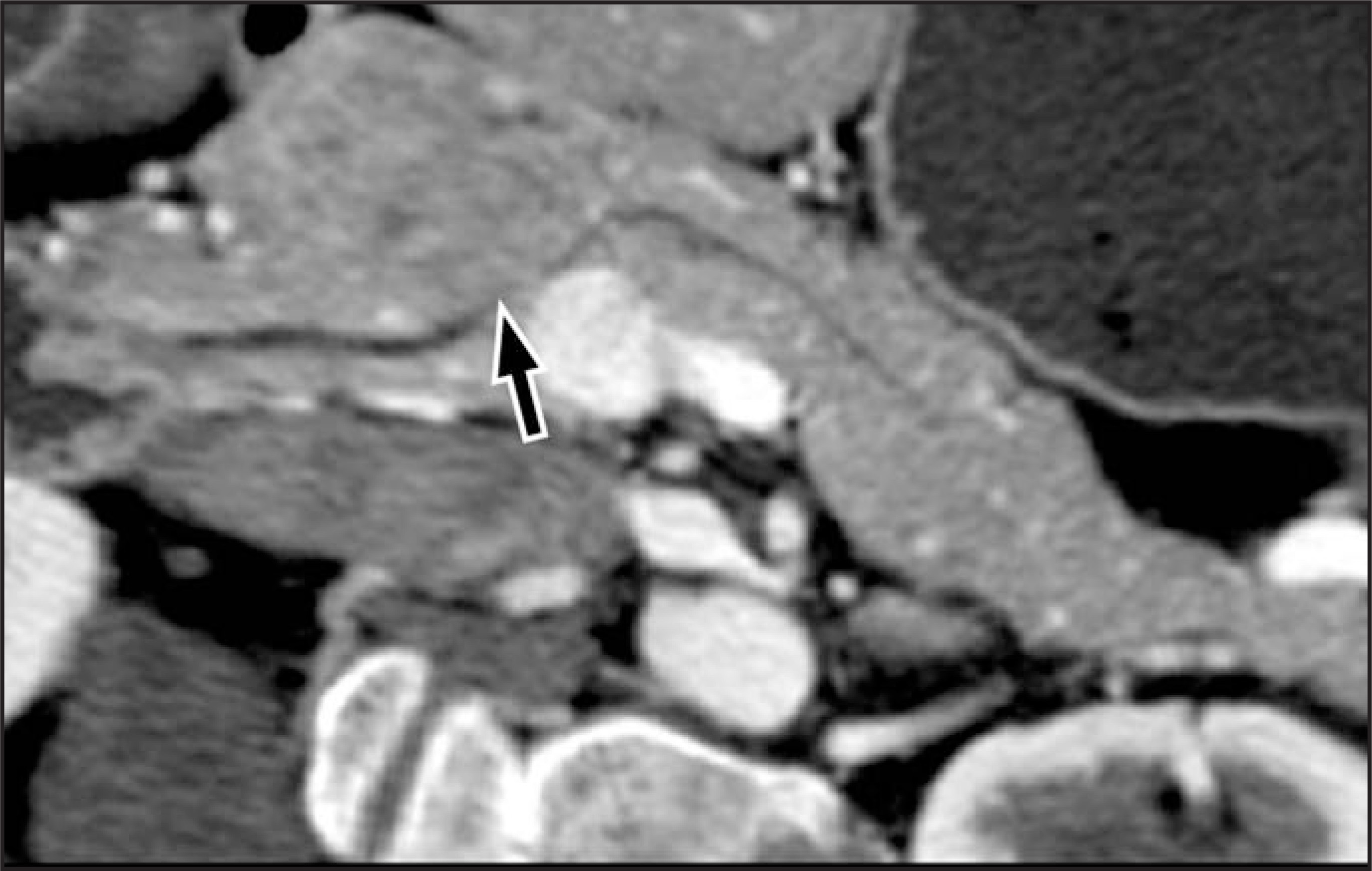 FIGURE 18.