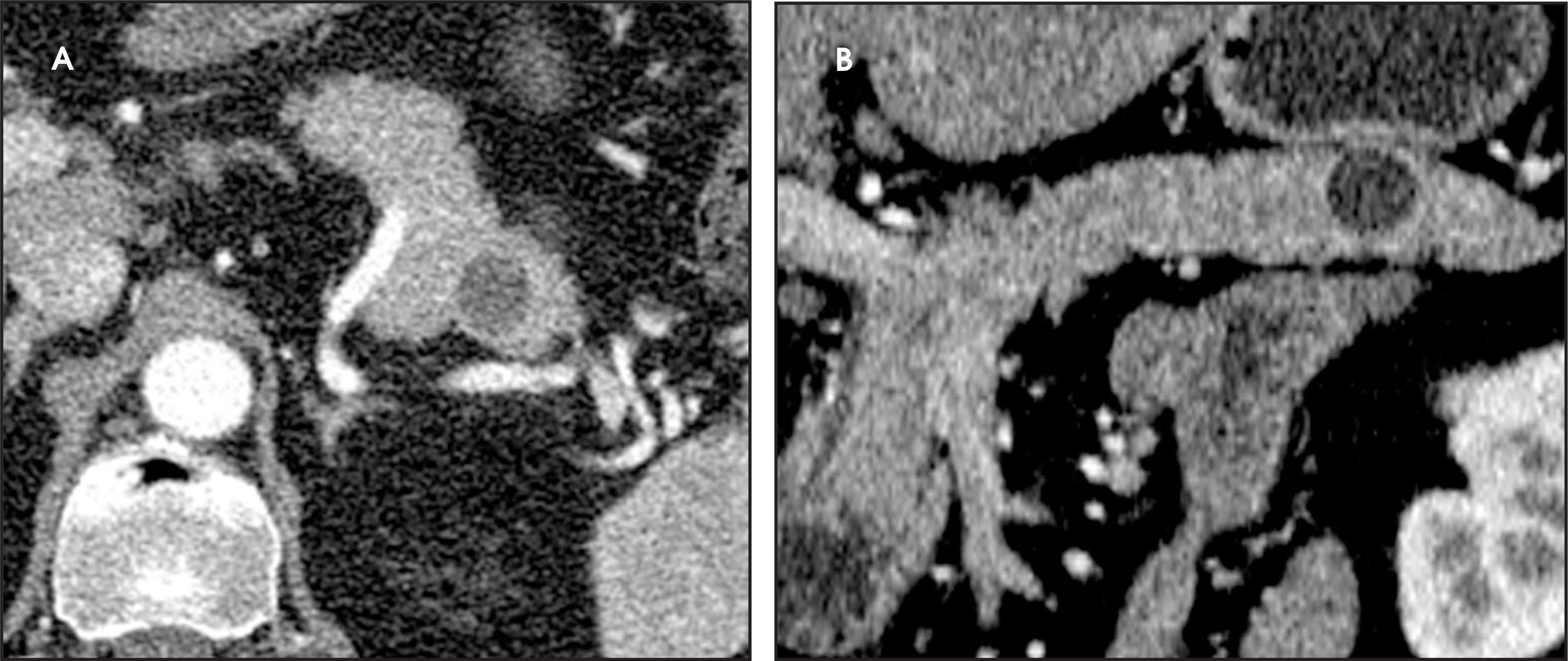 FIGURE 21.