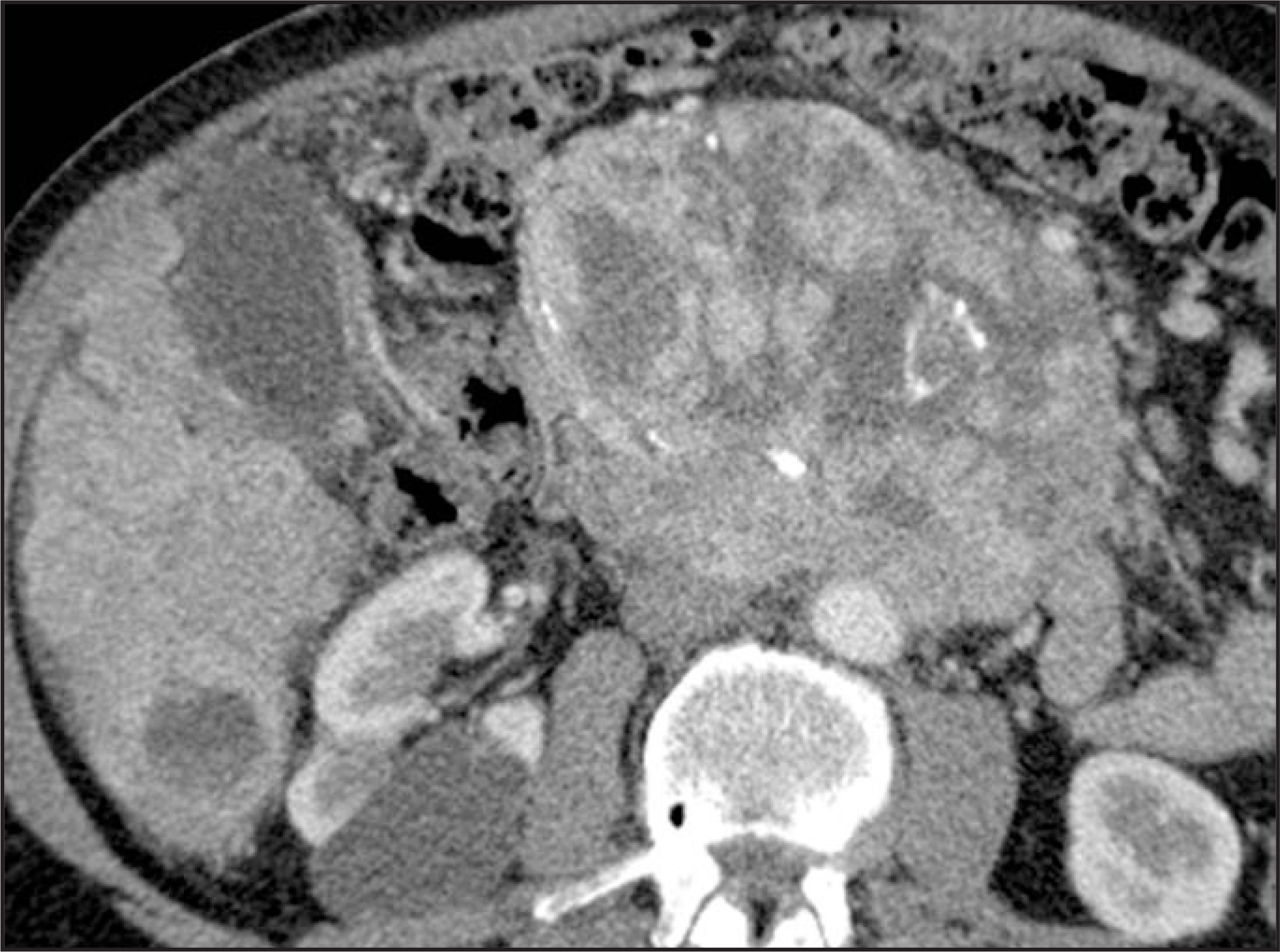 FIGURE 22.
