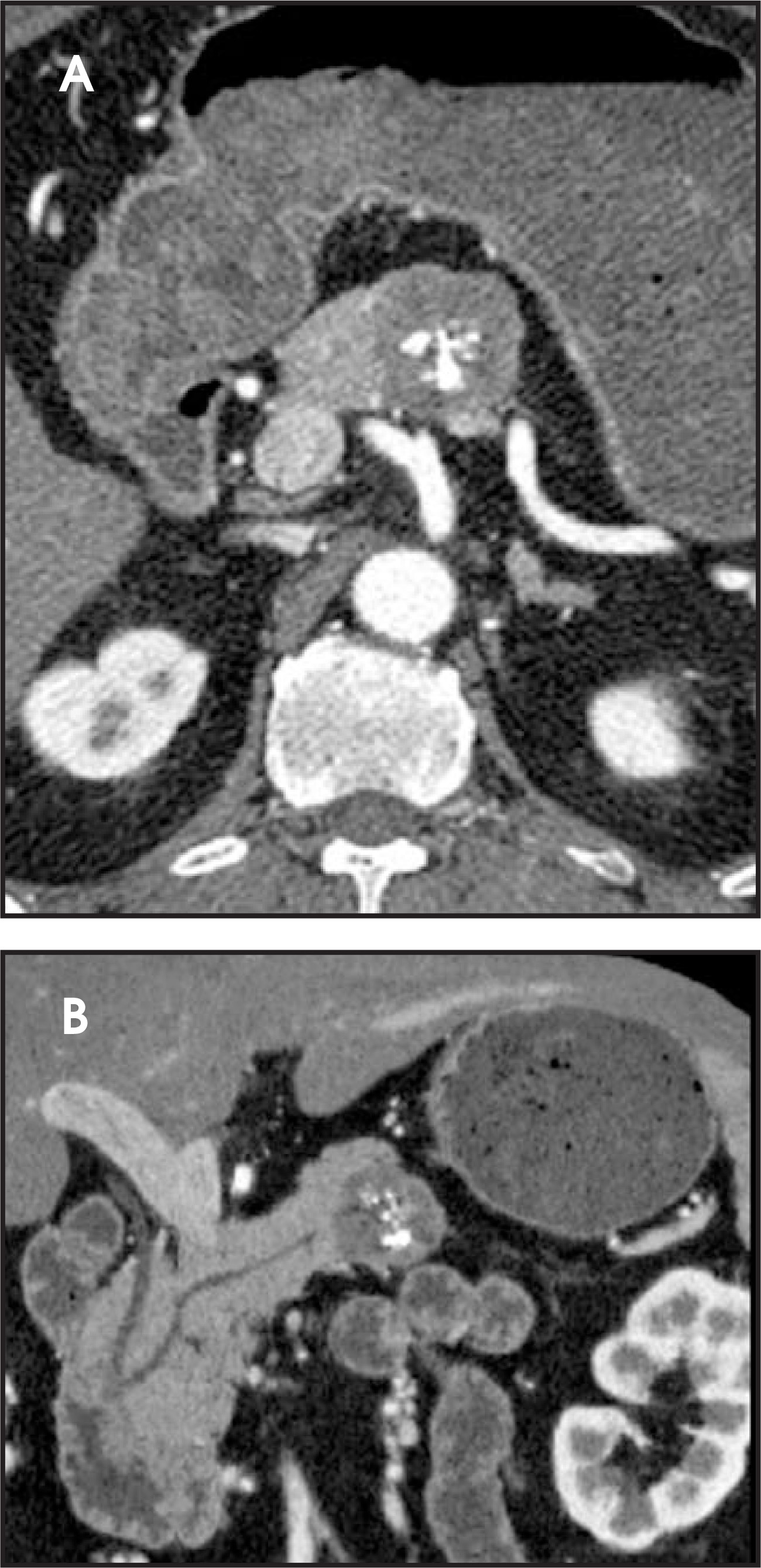 FIGURE 23.