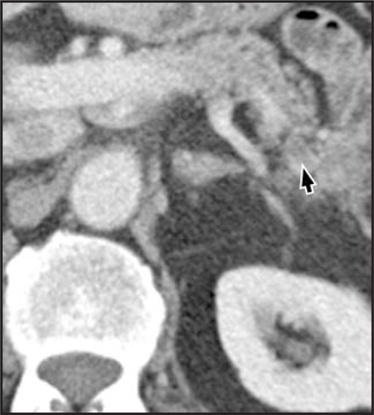 FIGURE 25.