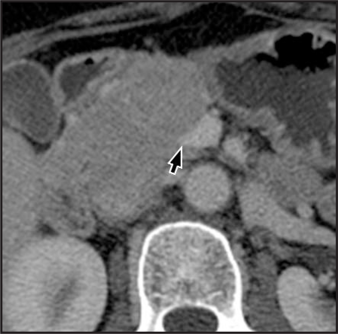 FIGURE 26.