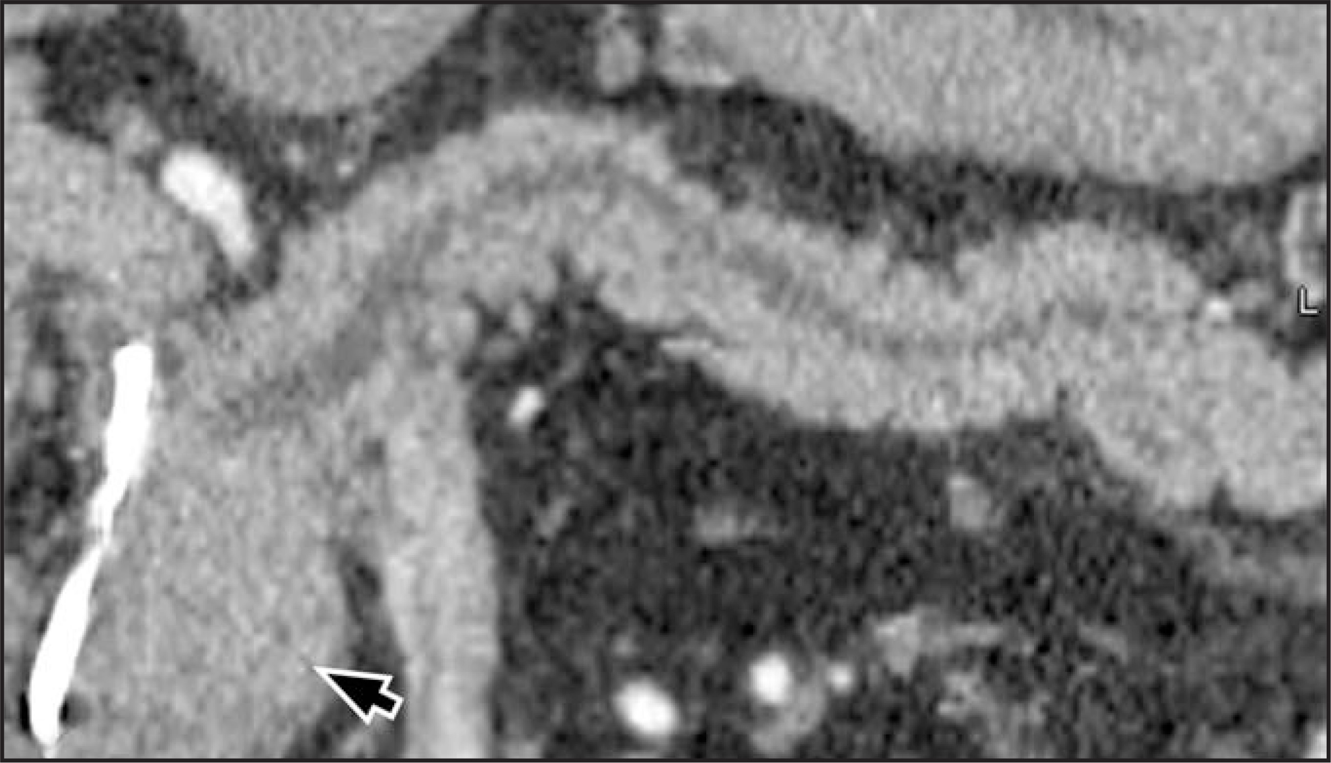 FIGURE 30.