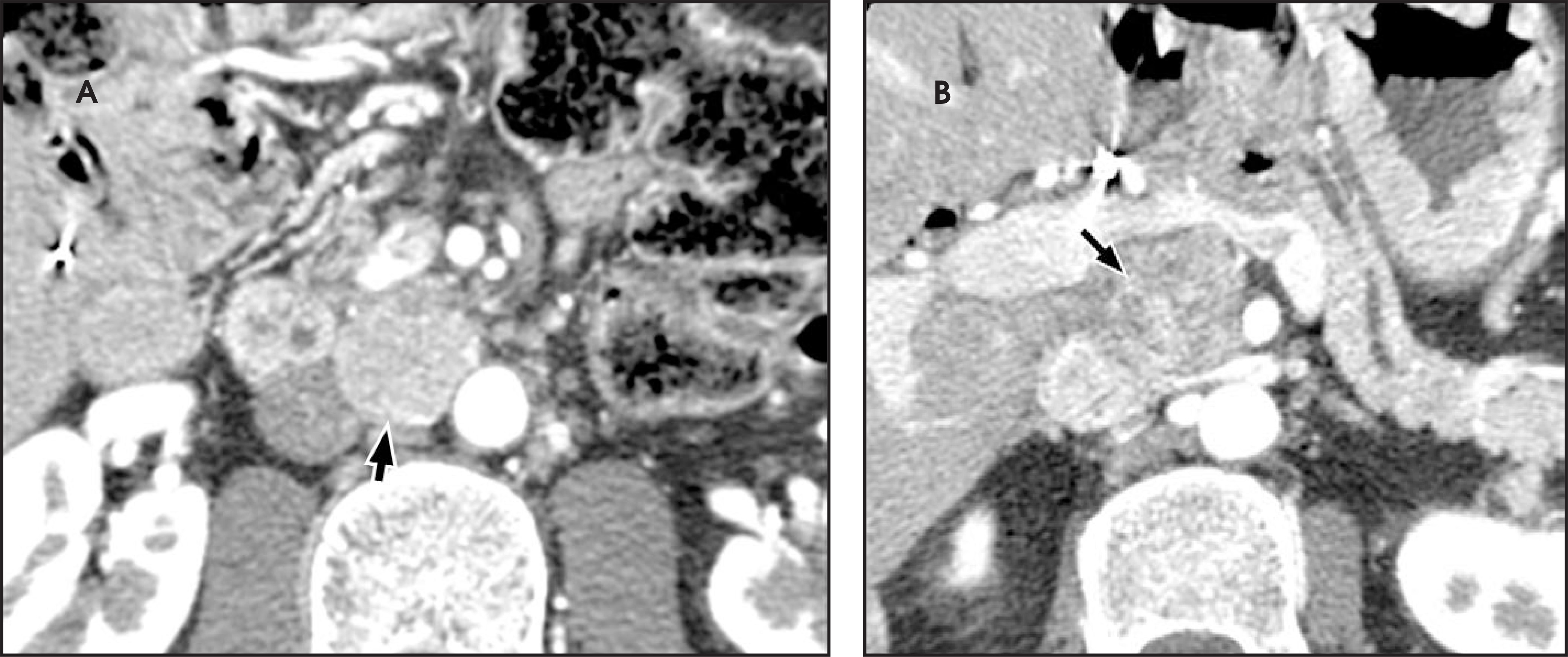 FIGURE 32.