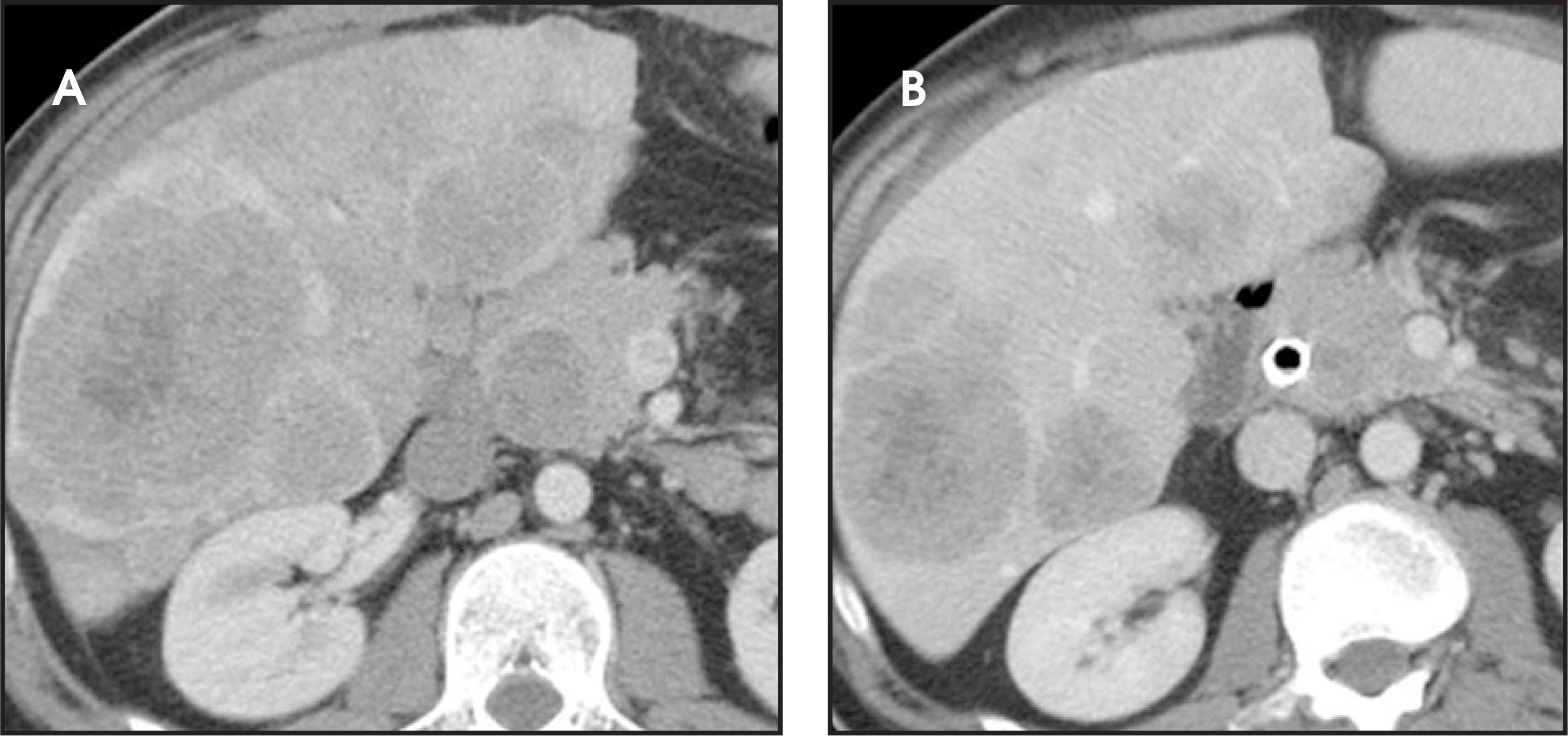 FIGURE 33.