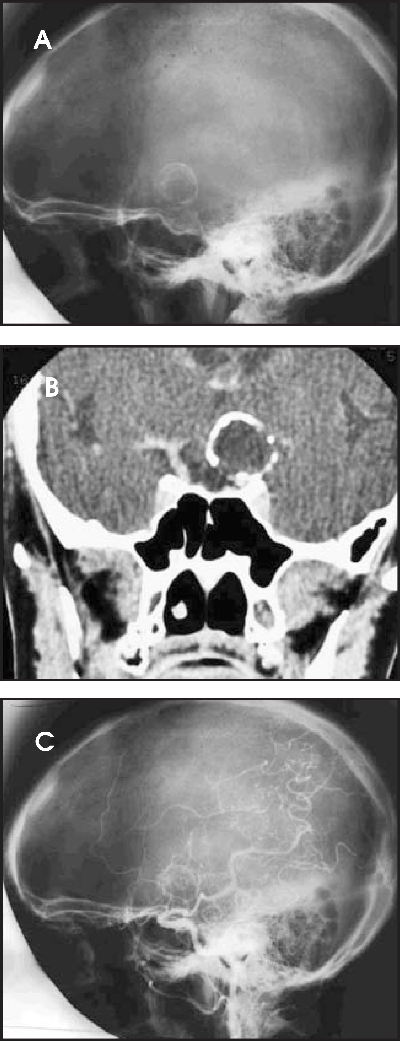 FIGURE 13.