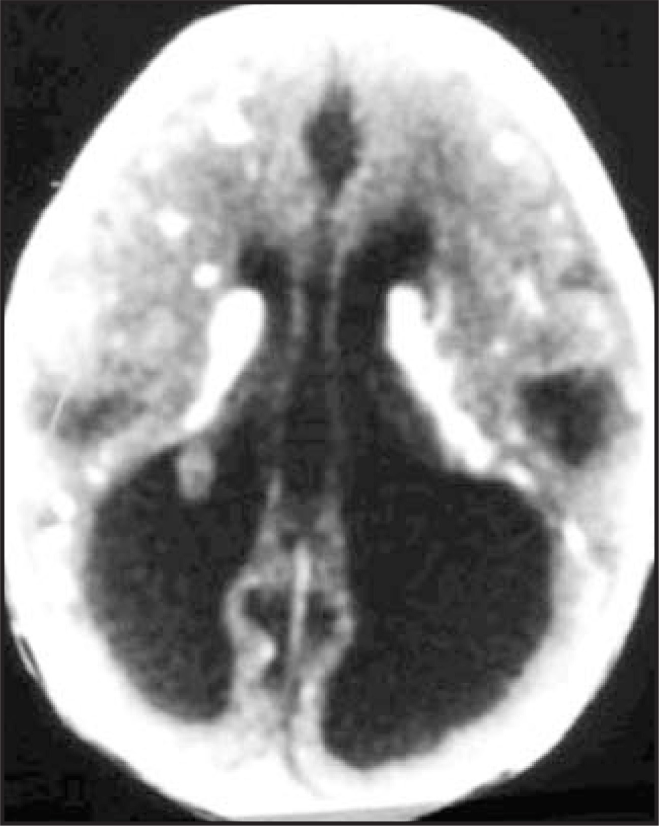 FIGURE 14.
