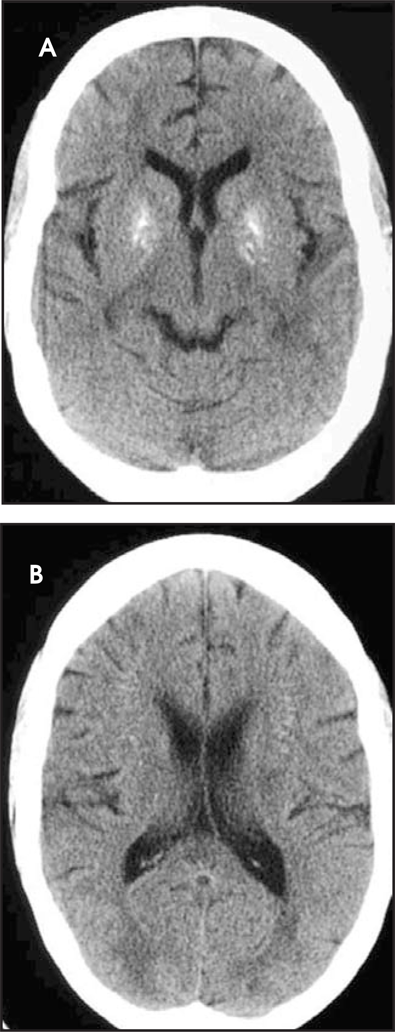 FIGURE 17.