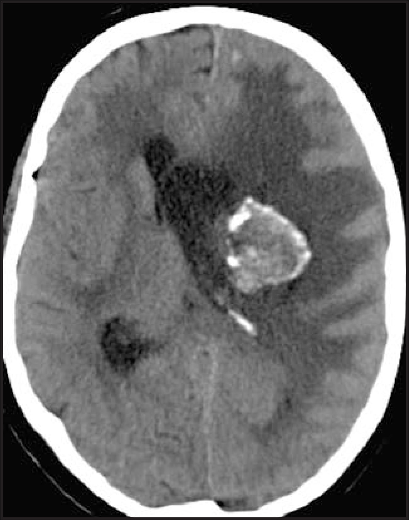 FIGURE 19.
