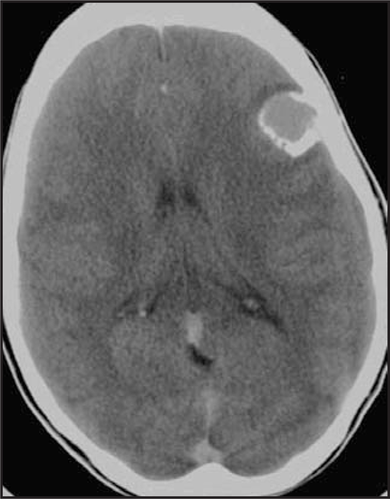 FIGURE 20.