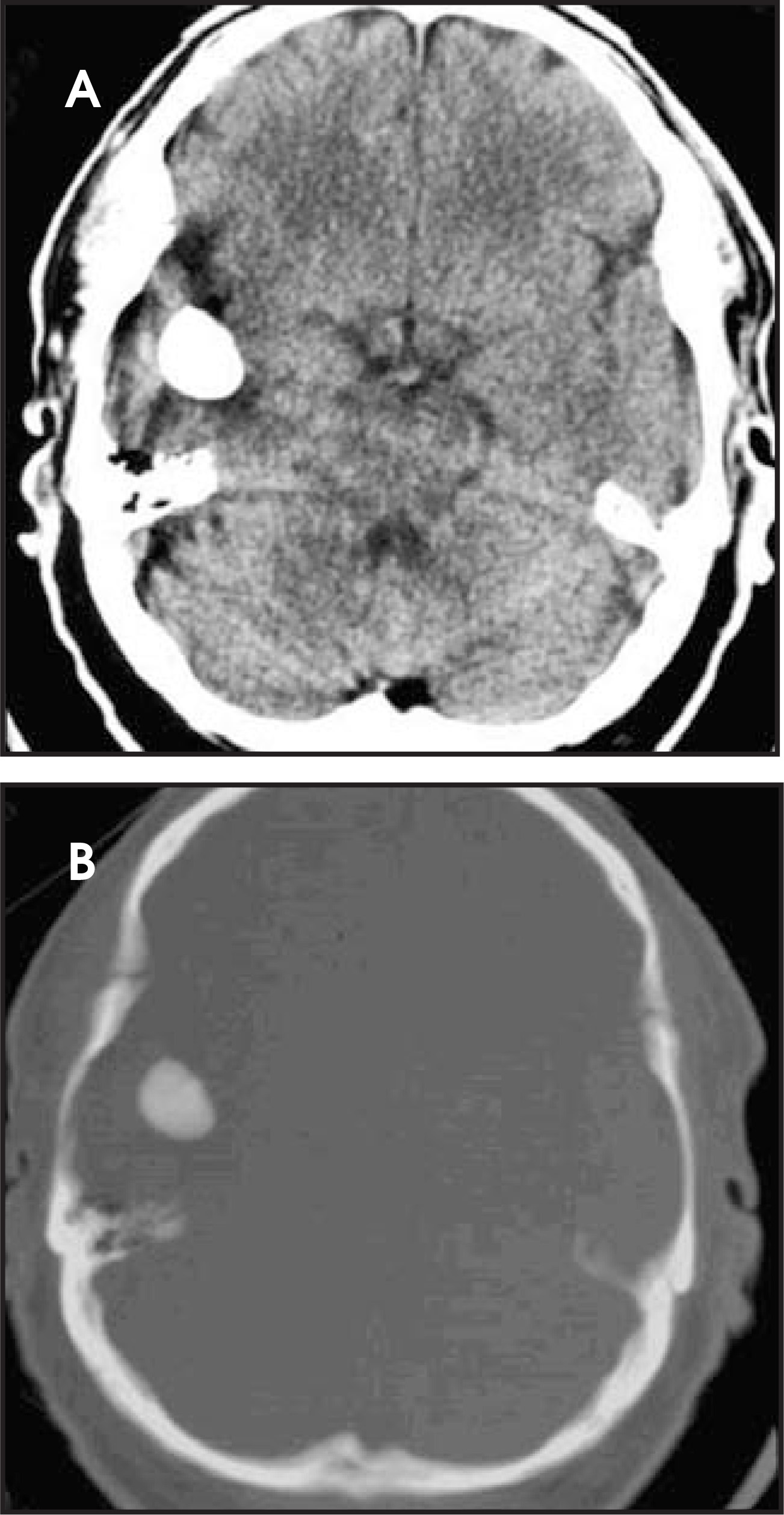 FIGURE 21.