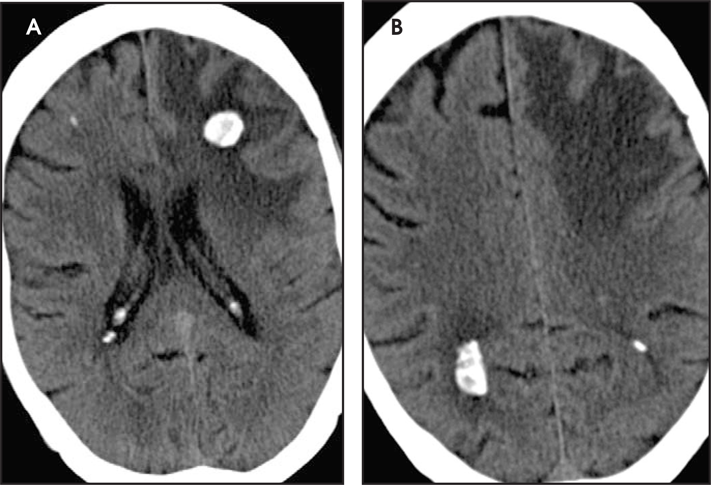 FIGURE 22.