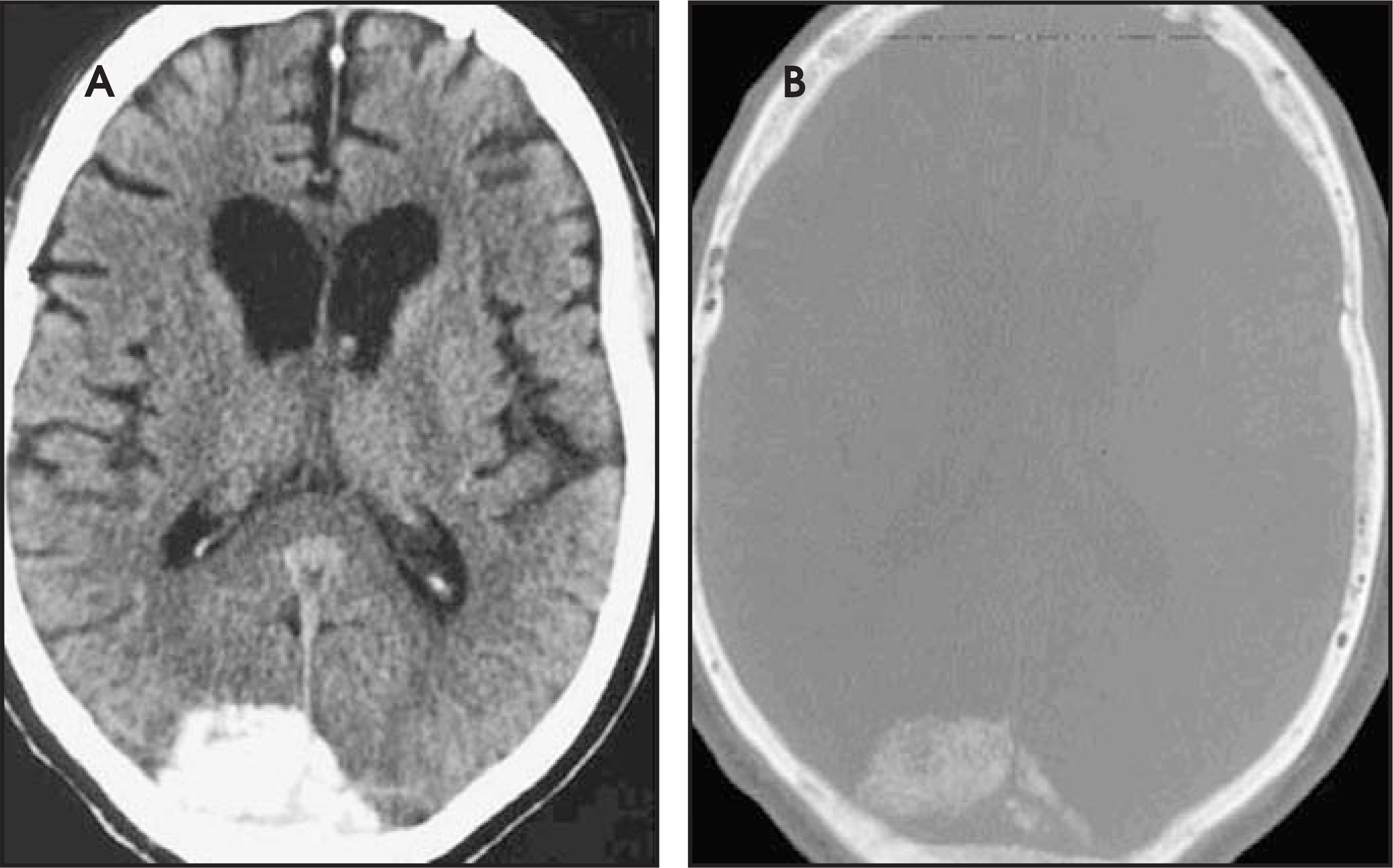 FIGURE 23.