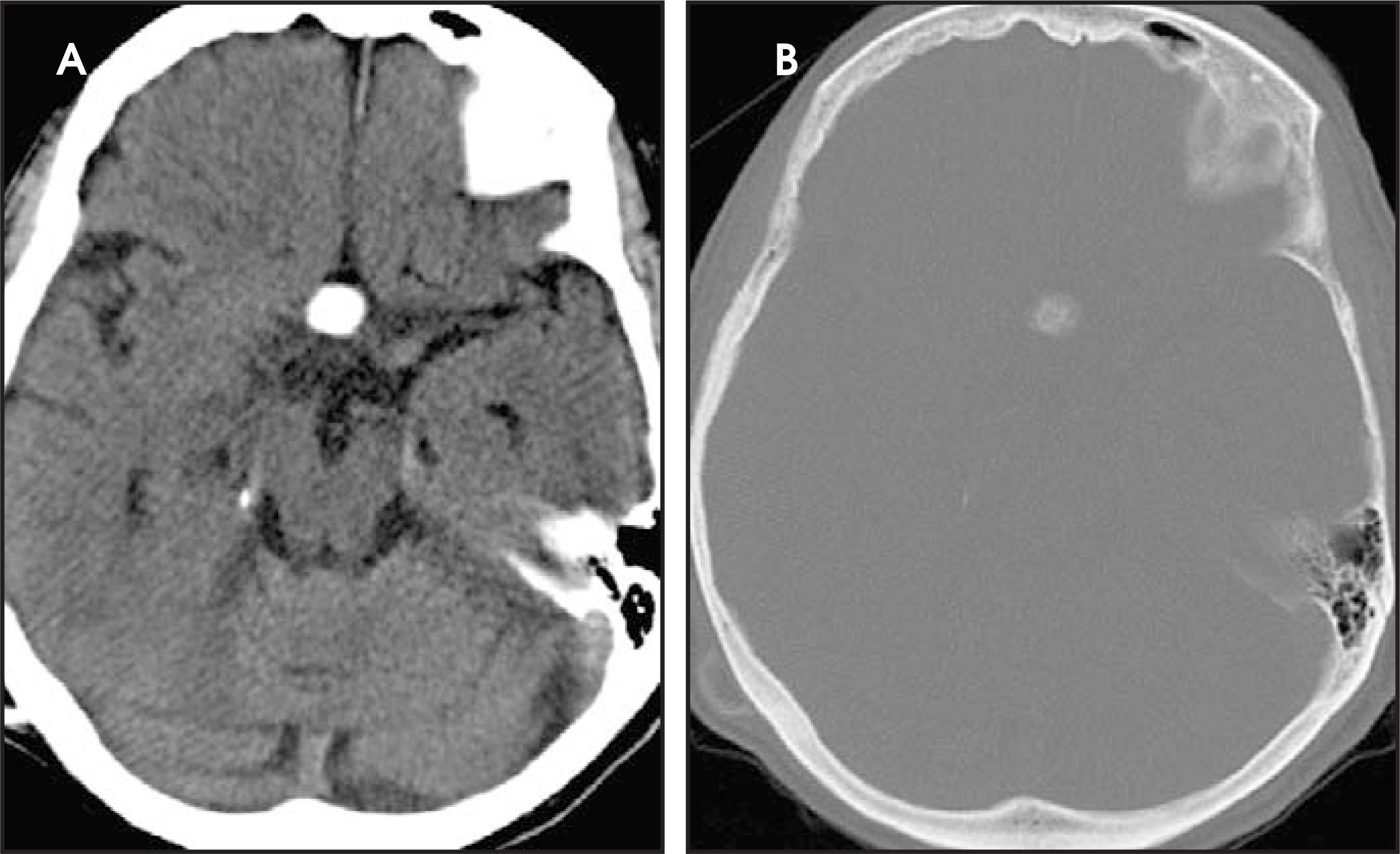 FIGURE 25.