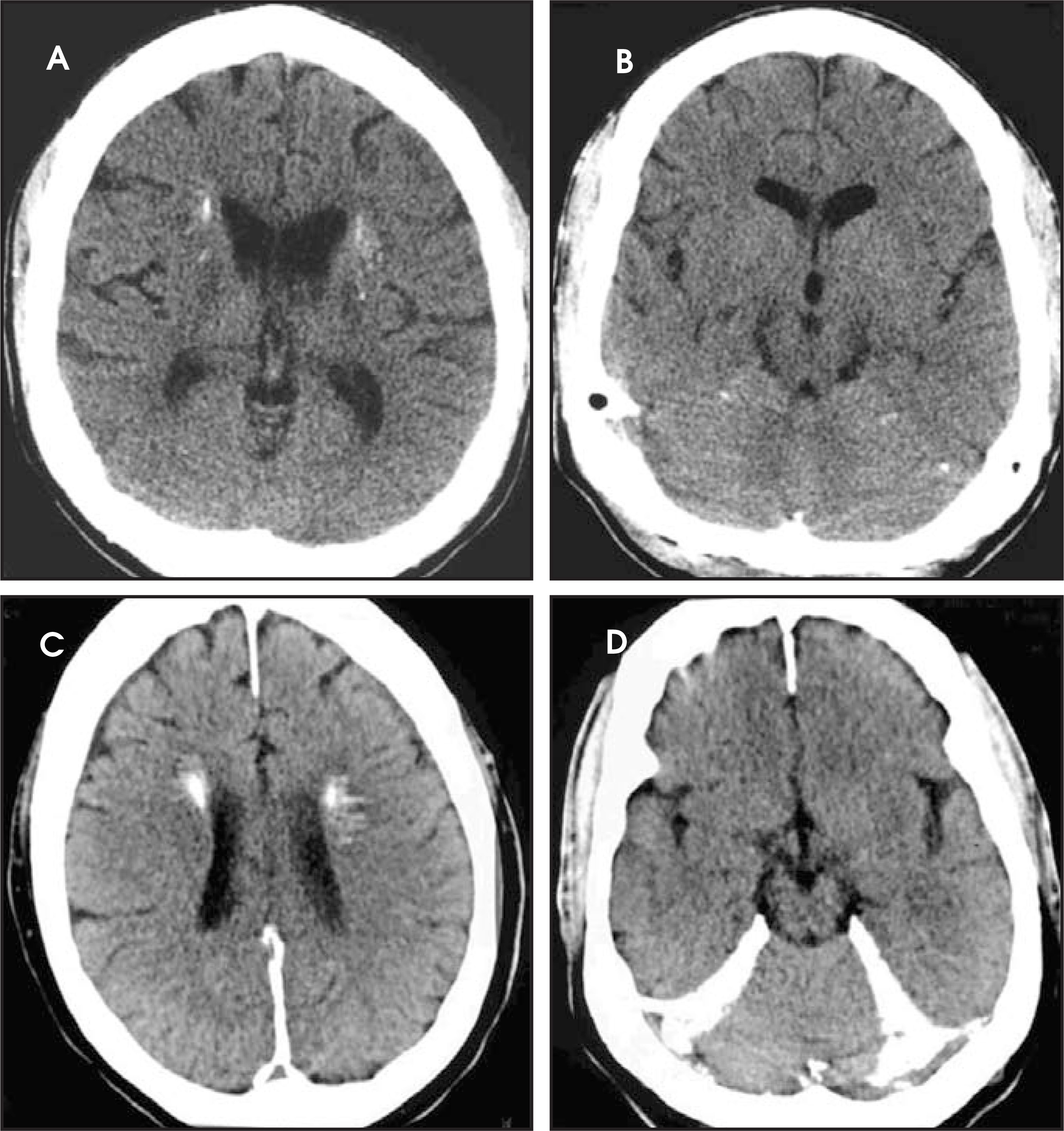 FIGURE 29.