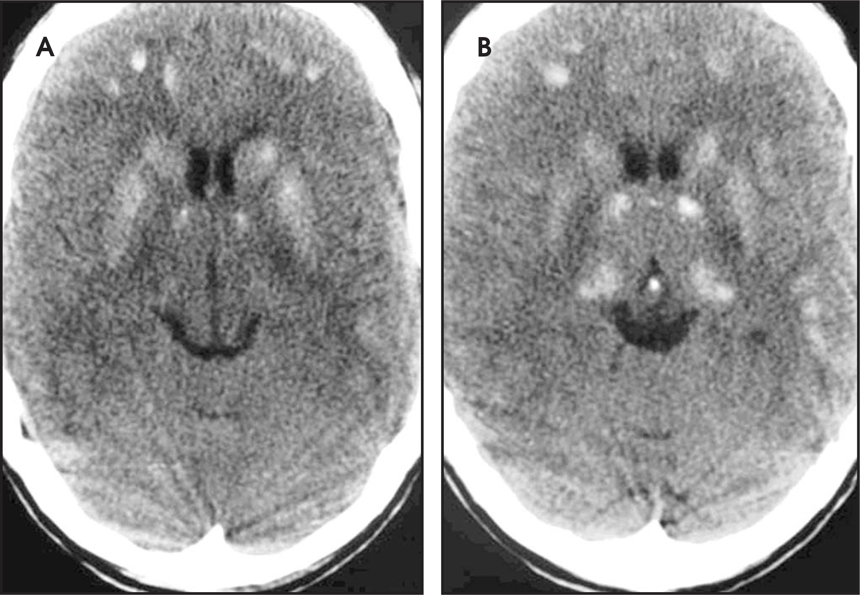 FIGURE 30.