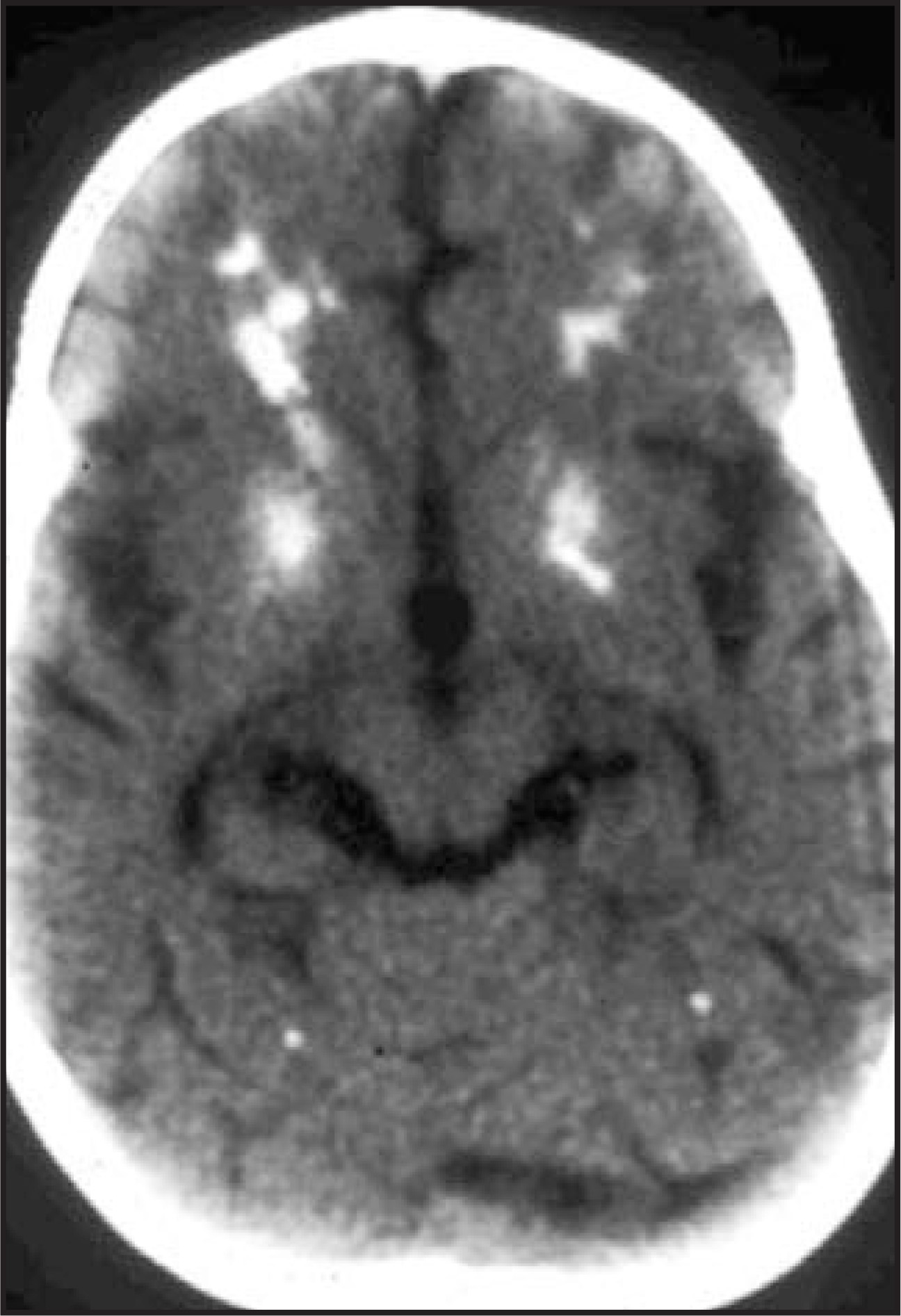 FIGURE 31.