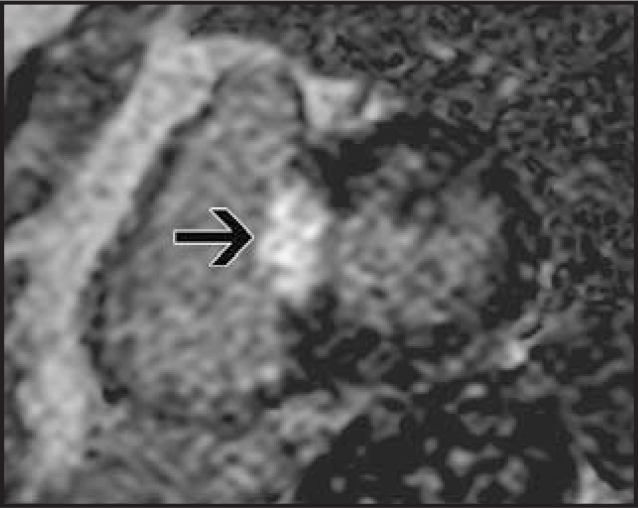 FIGURE 9.