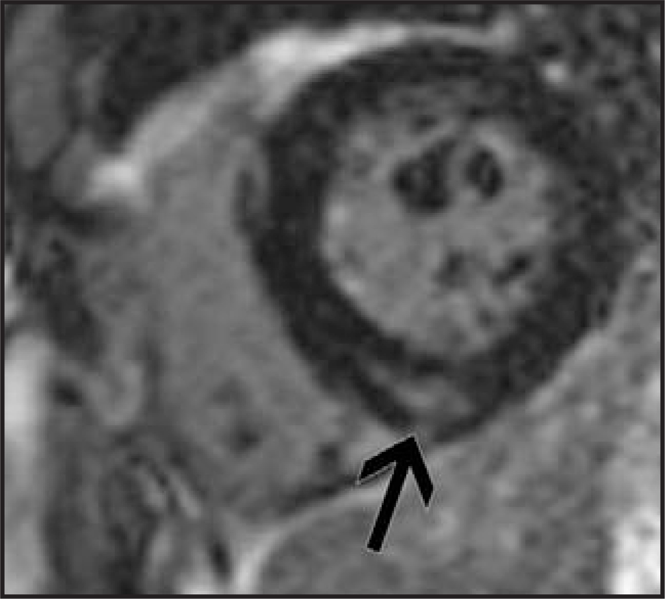 FIGURE 11.