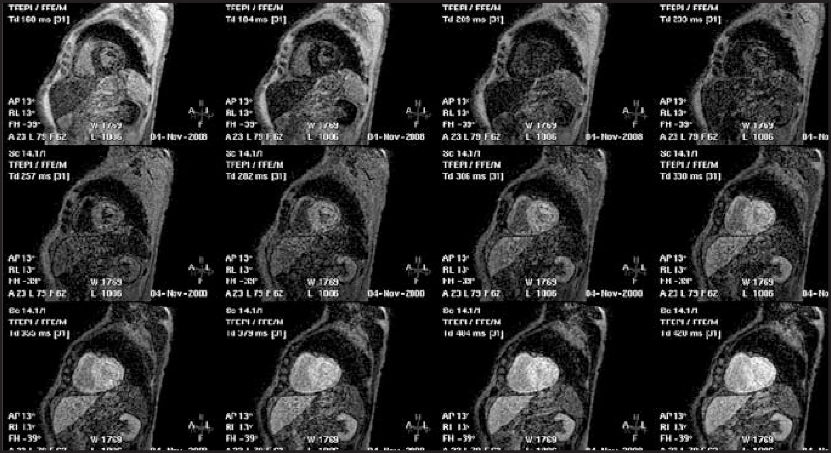 FIGURE 13.