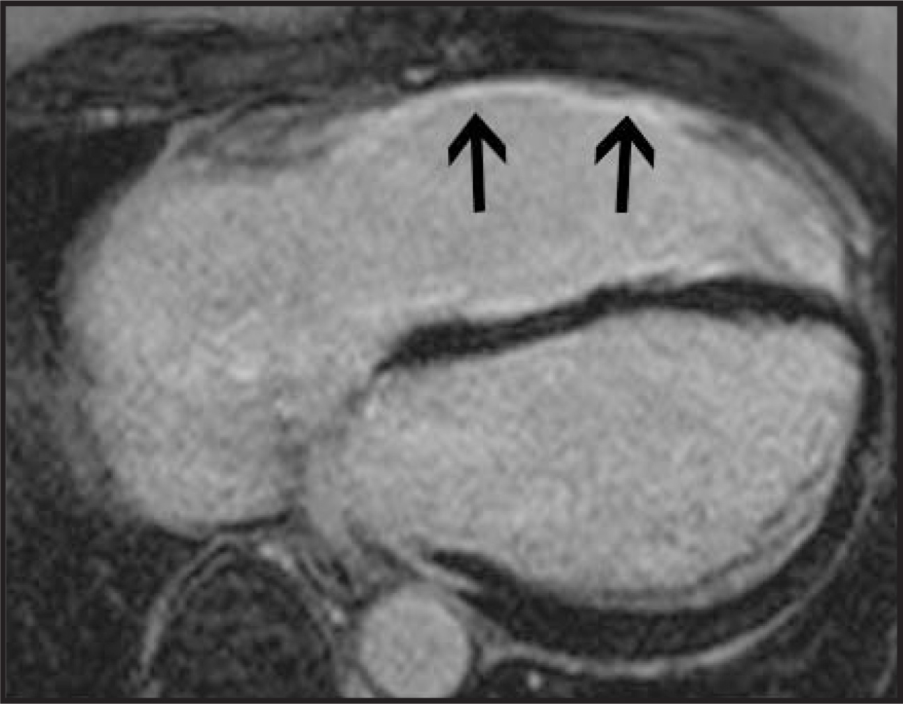 FIGURE 17.