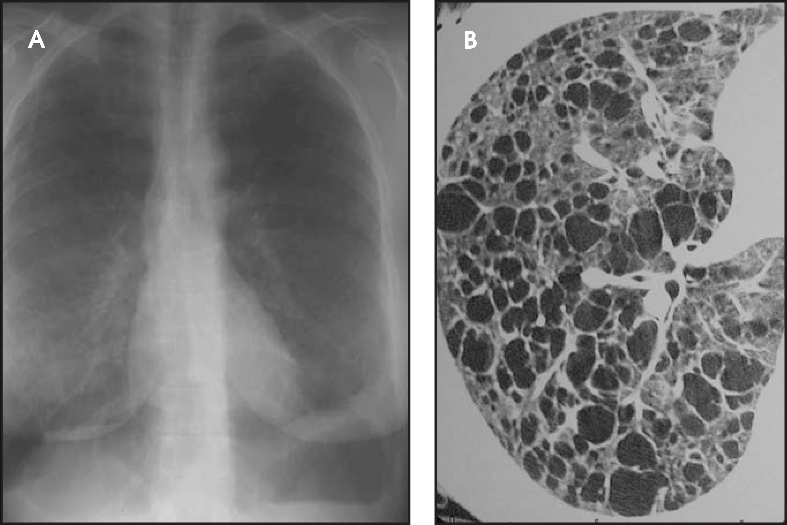 FIGURE 11.