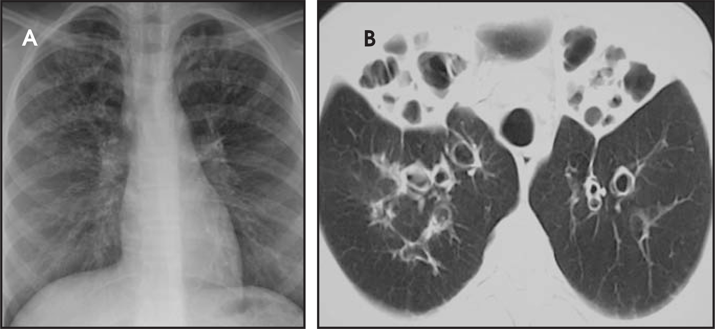 FIGURE 12.