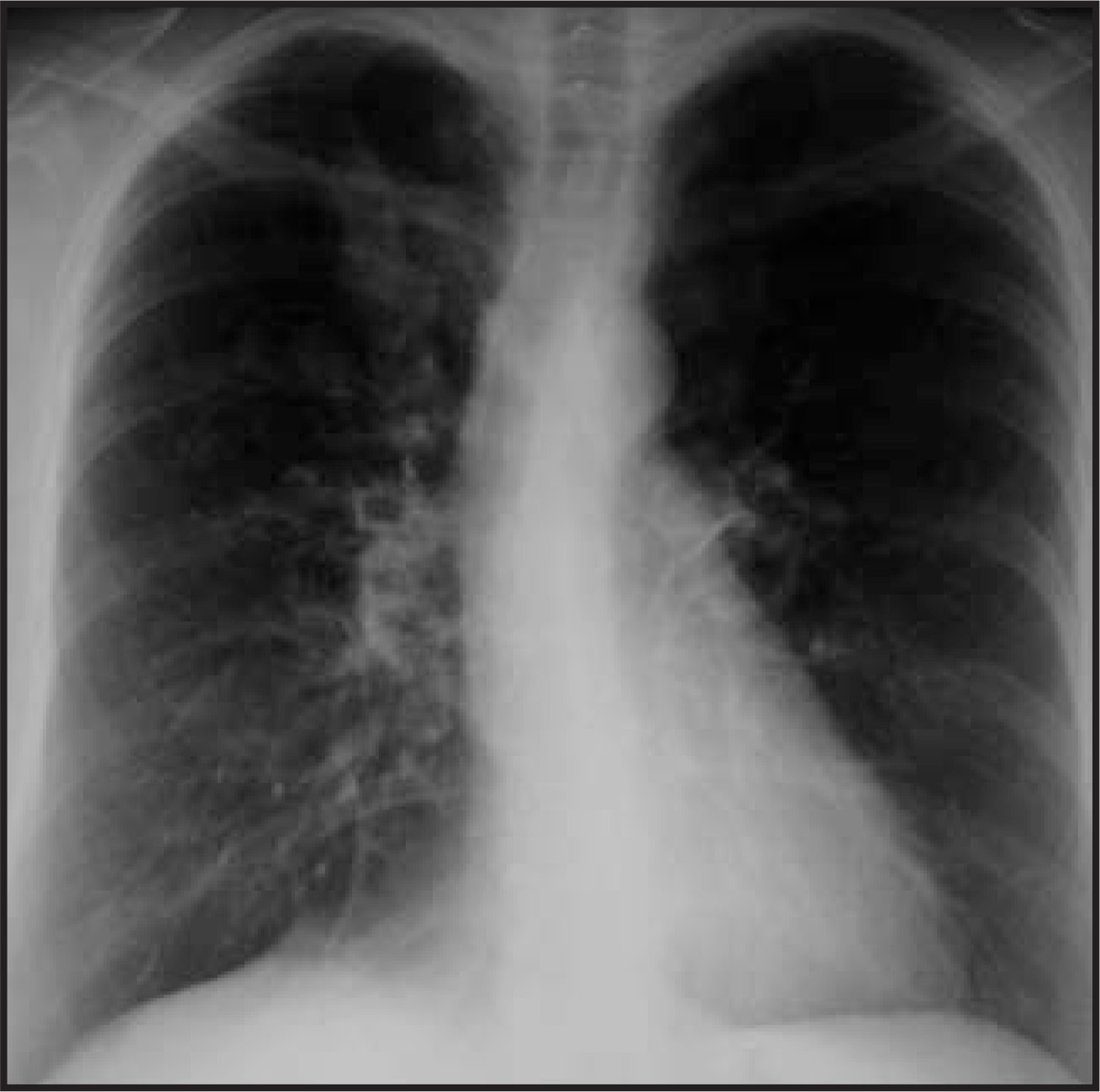 FIGURE 13.