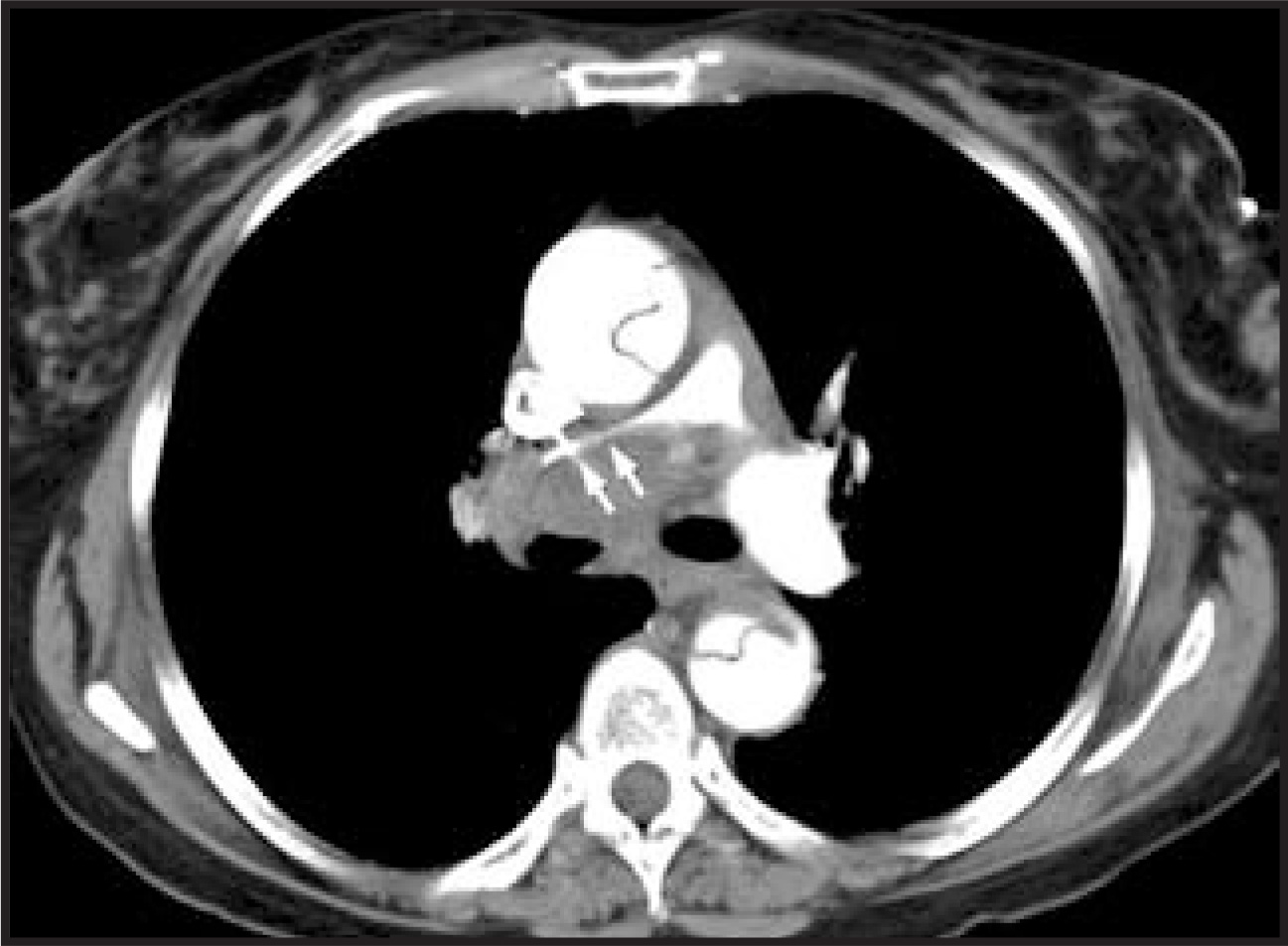 FIGURE 10.