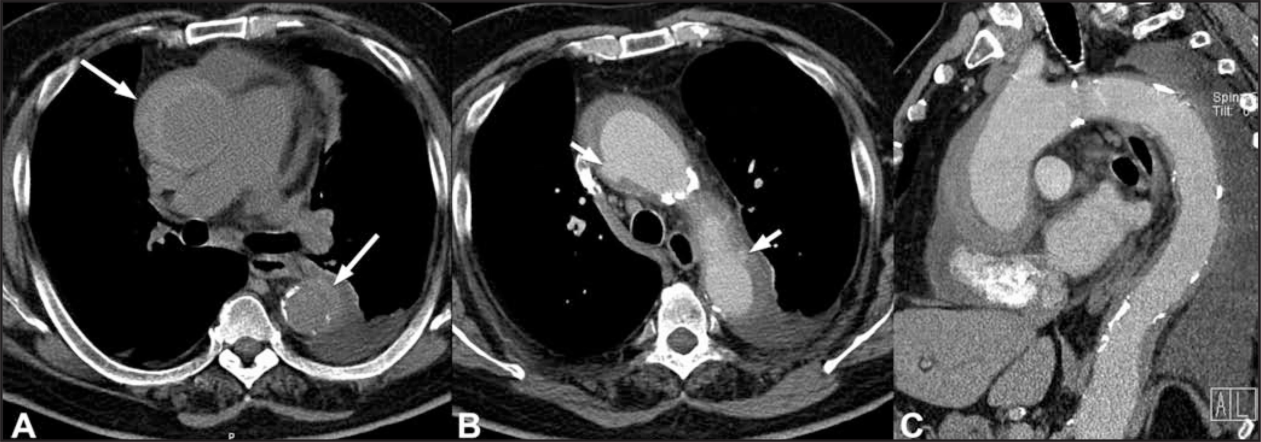 FIGURE 11.