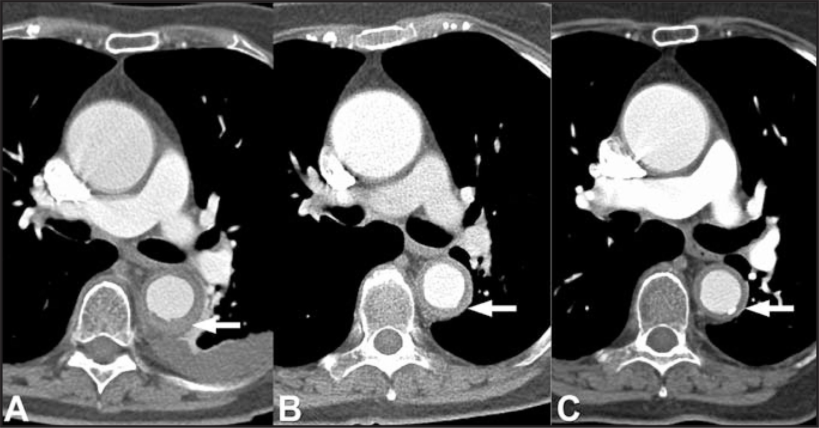 FIGURE 14.