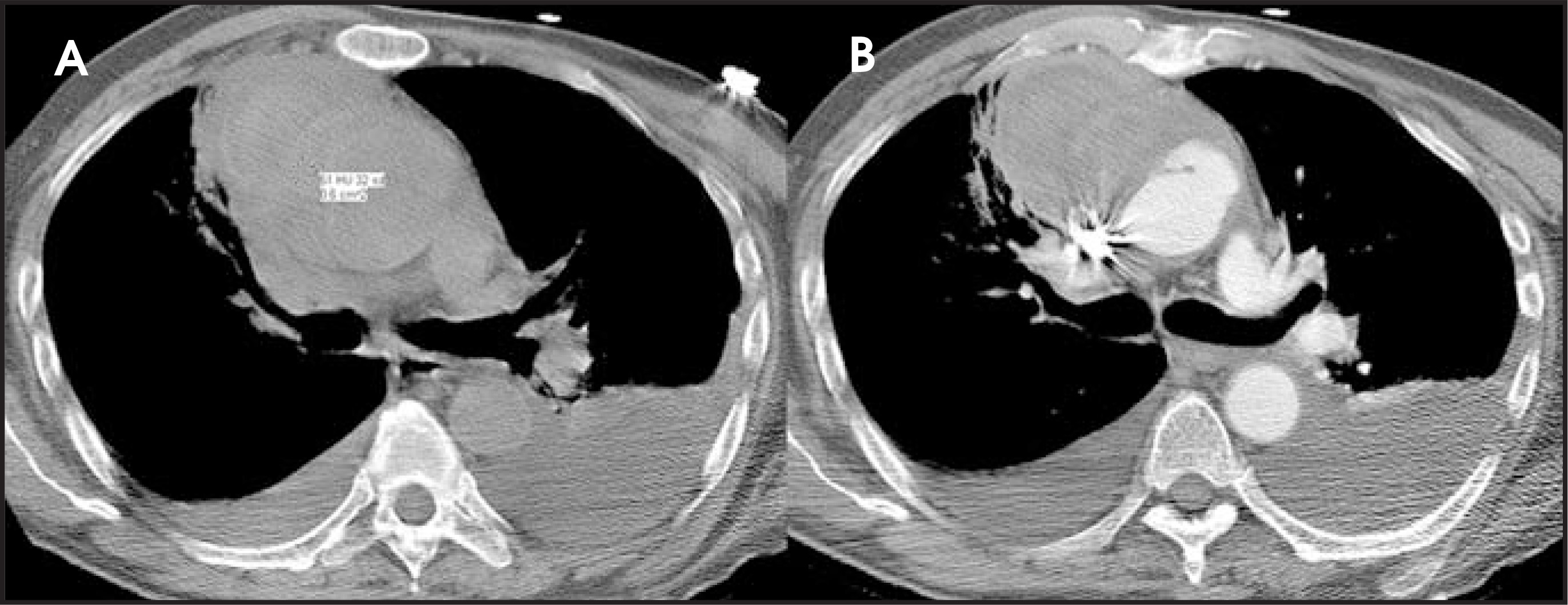 FIGURE 16.
