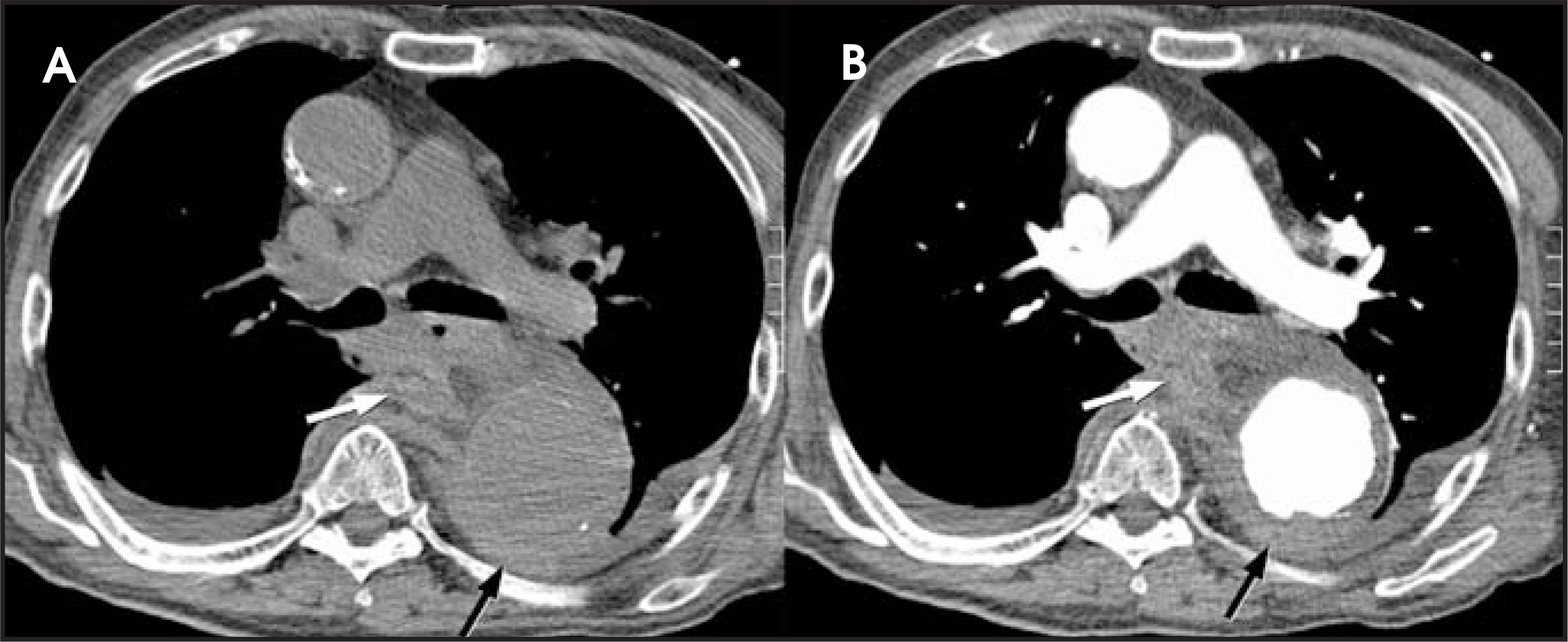FIGURE 17.