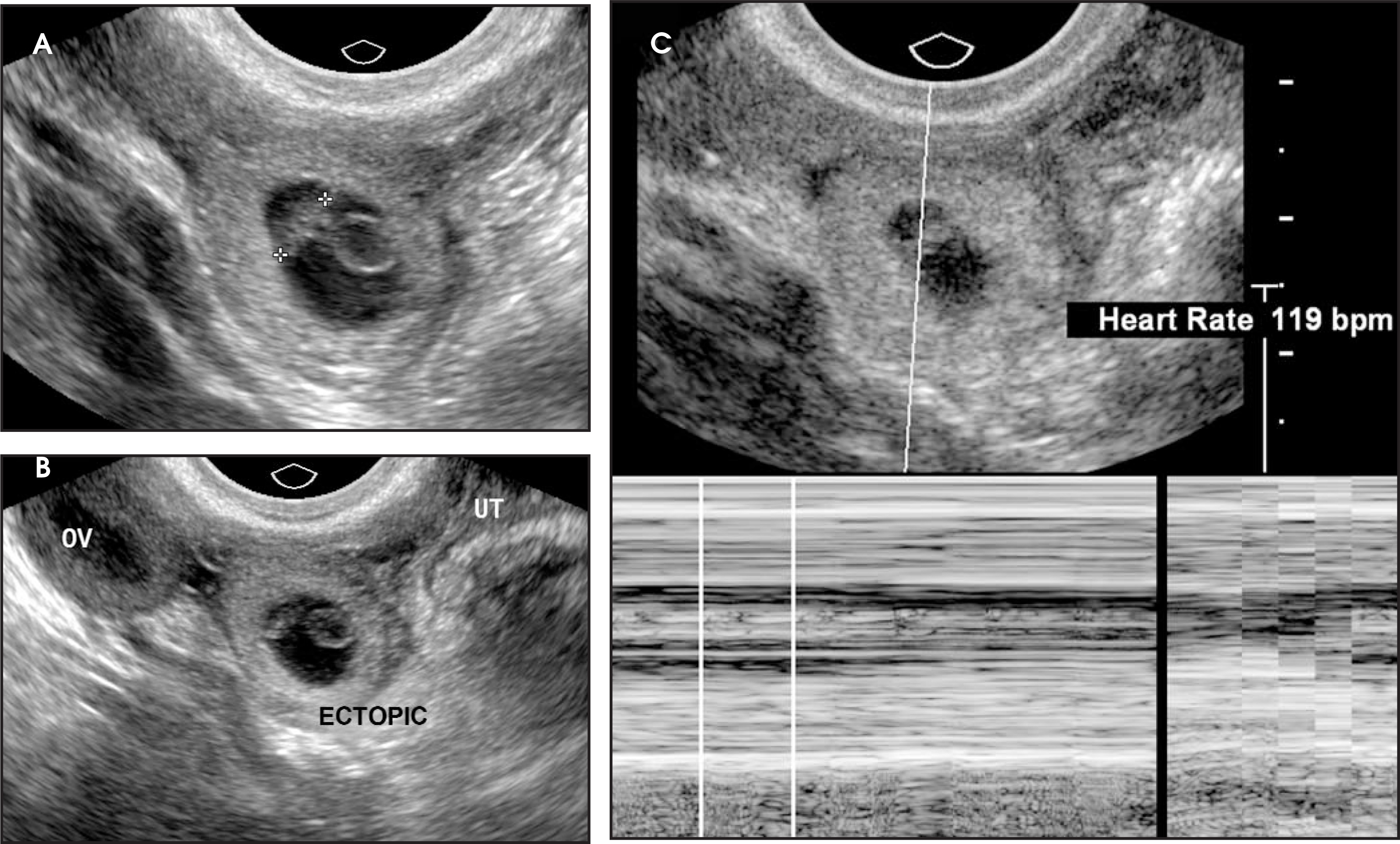 FIGURE 11.