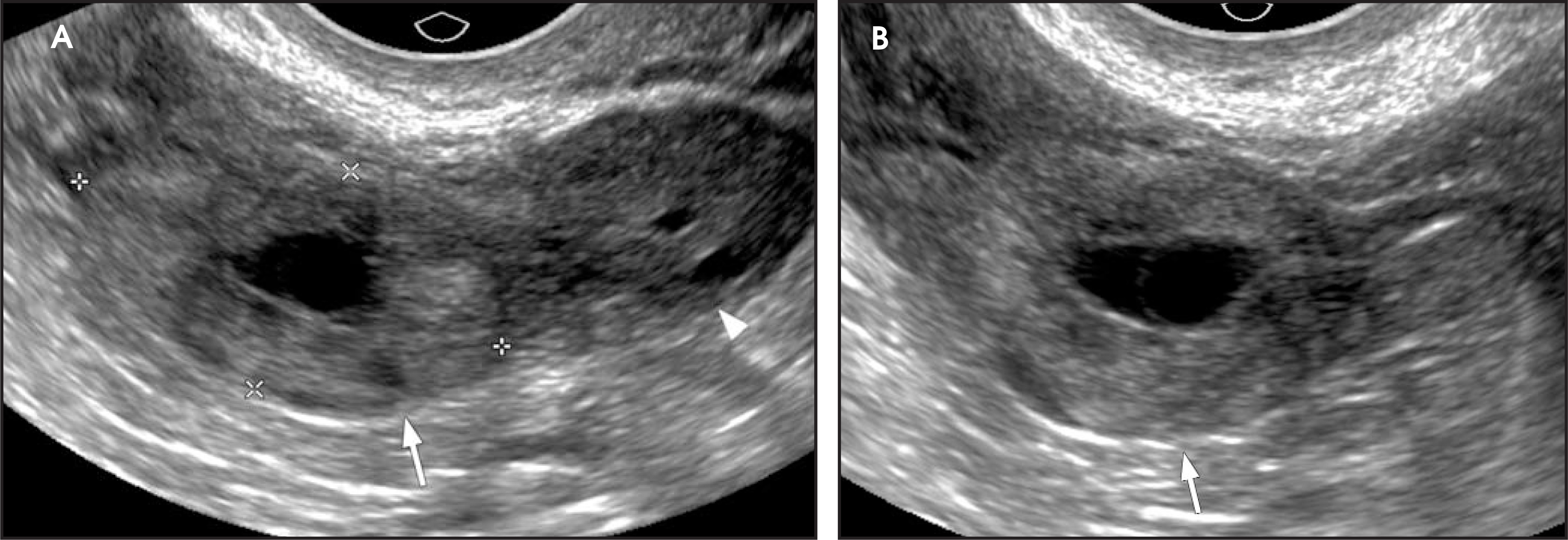 FIGURE 13.