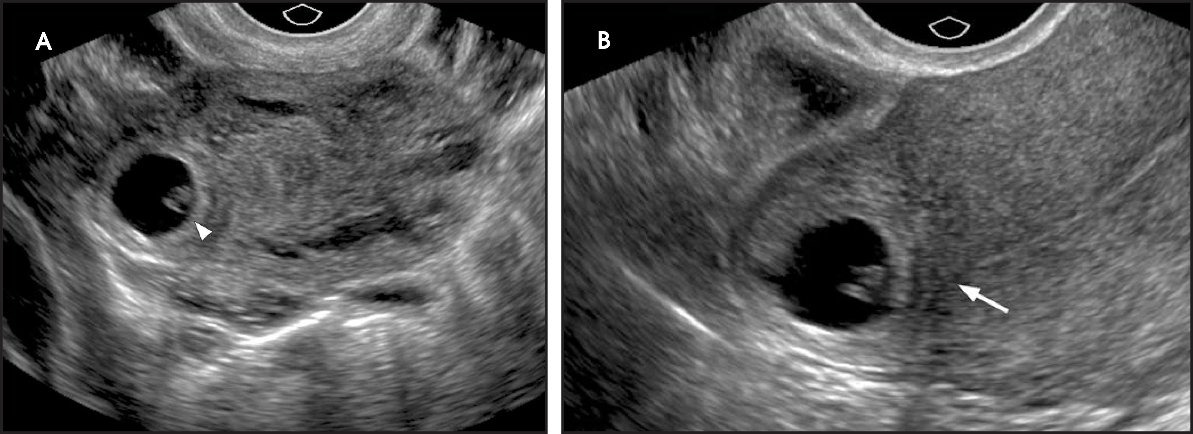 FIGURE 16.
