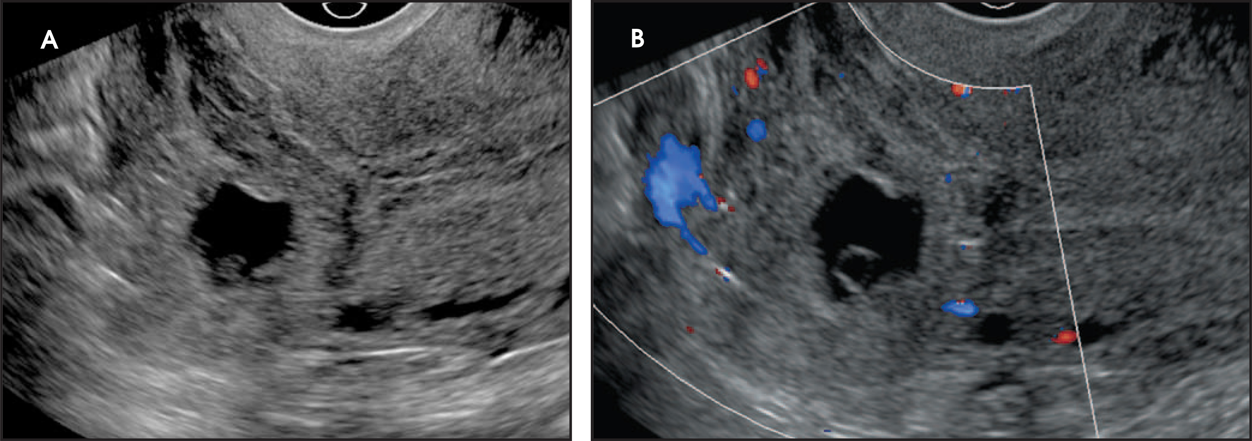FIGURE 17.