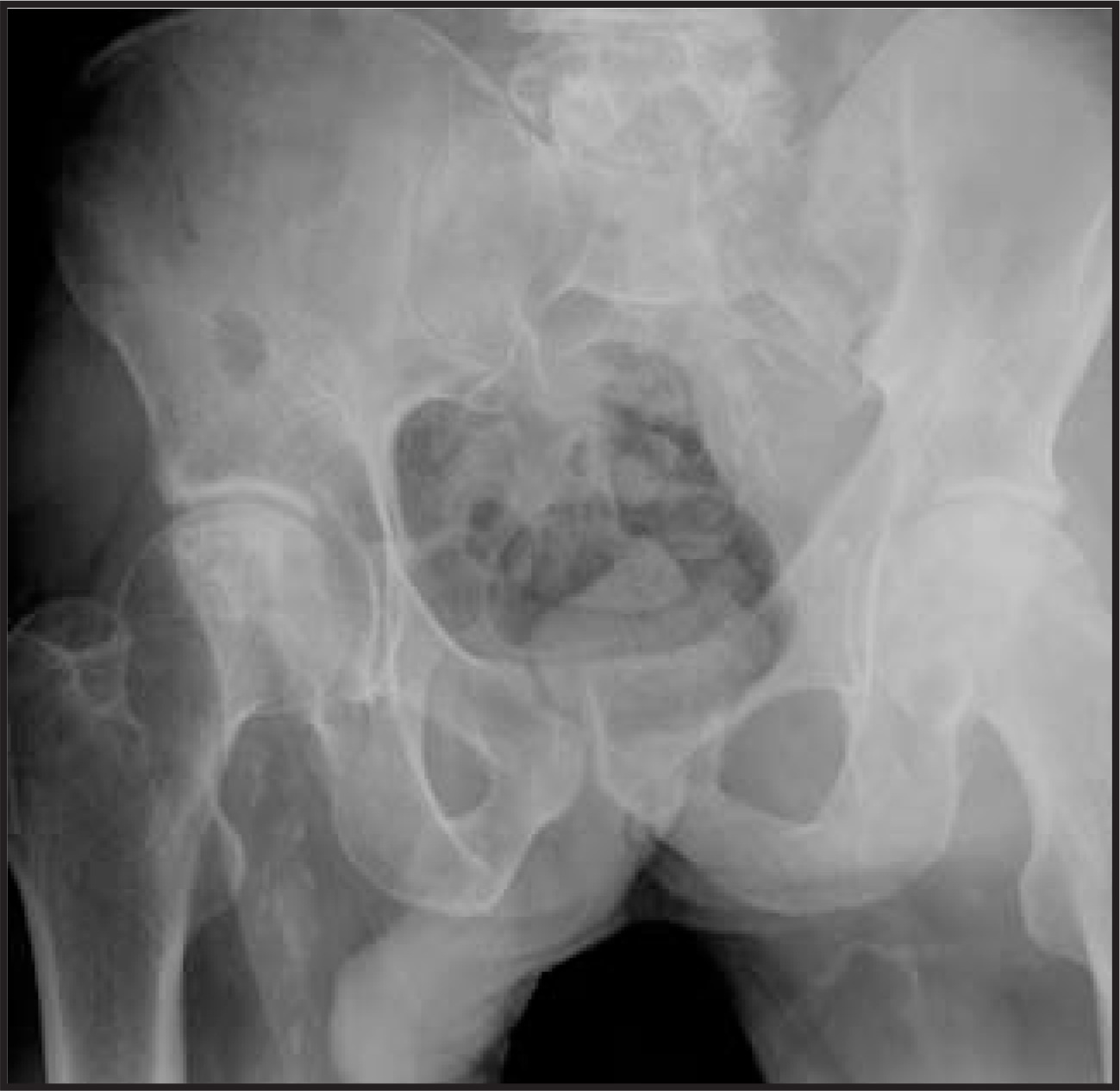 FIGURE 1.