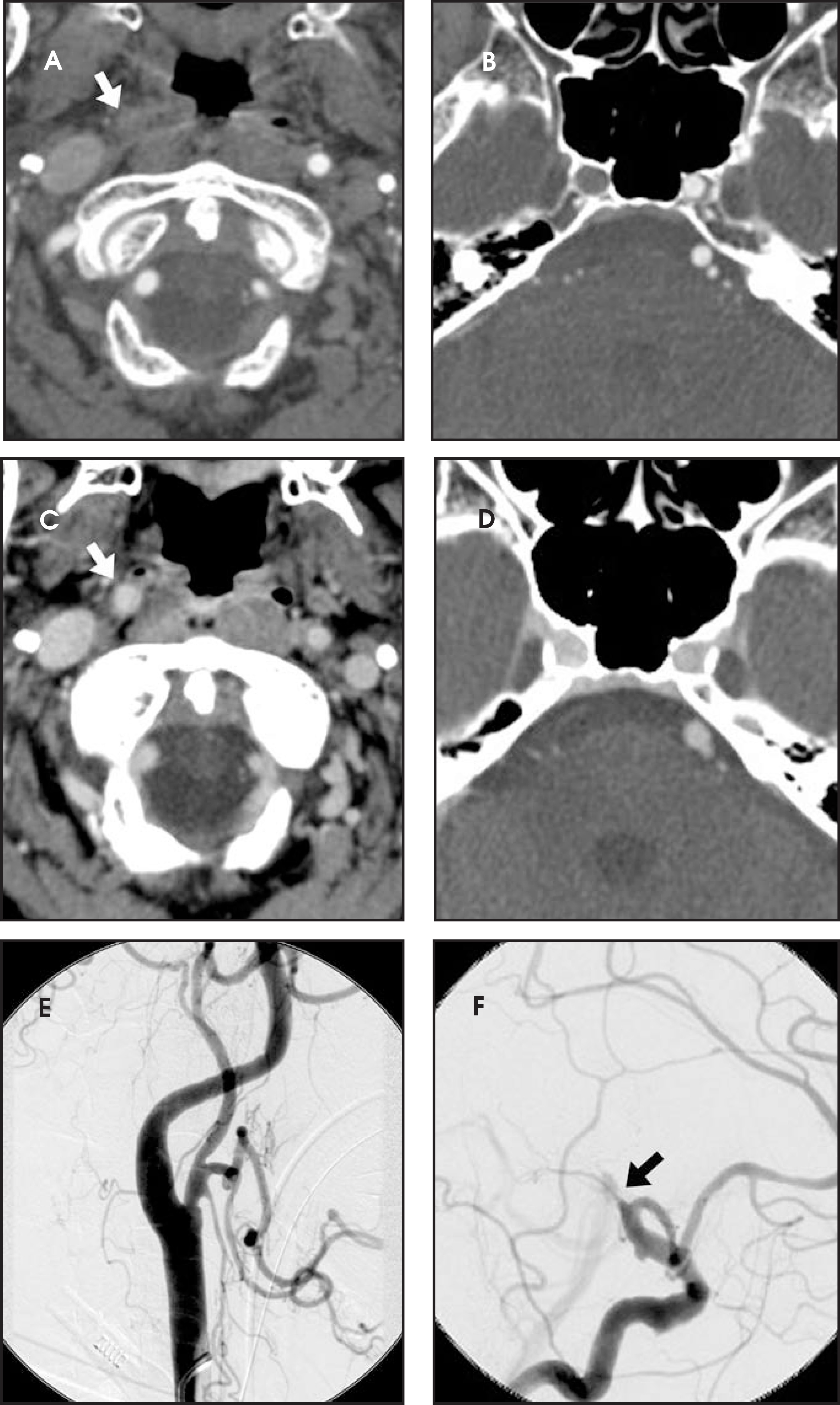 FIGURE 4.