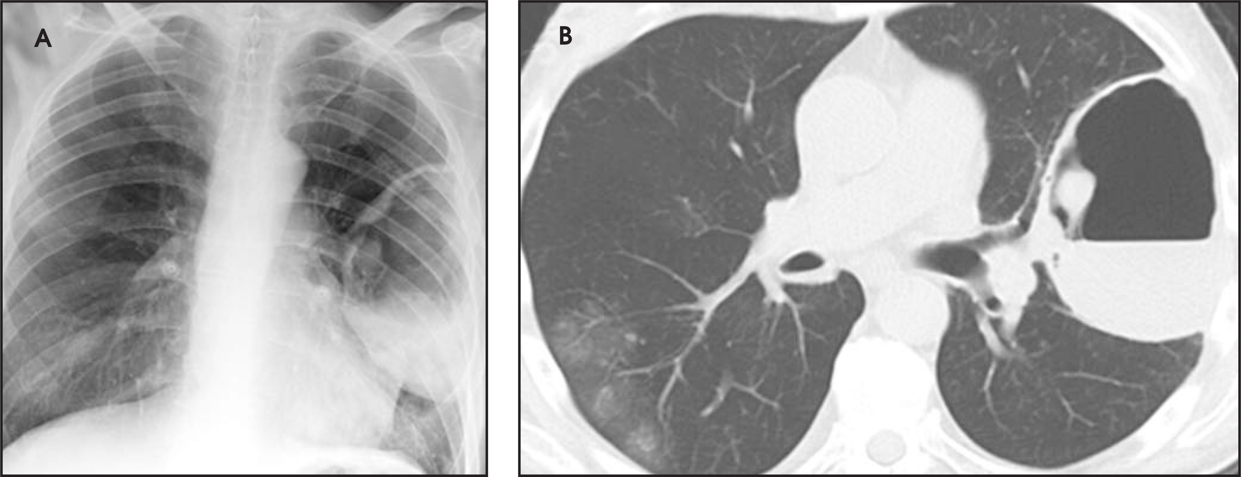 FIGURE 11.