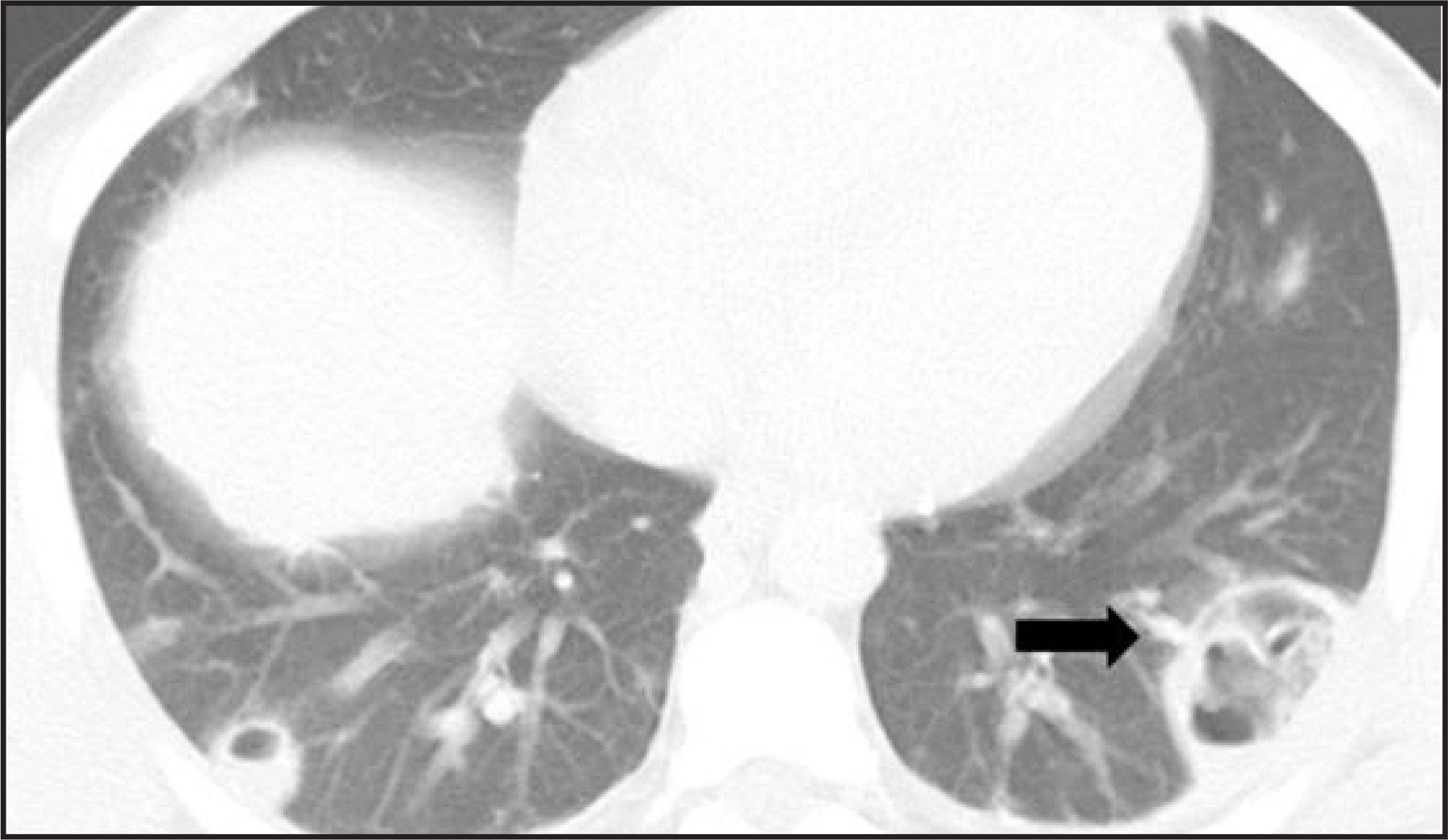 FIGURE 12.