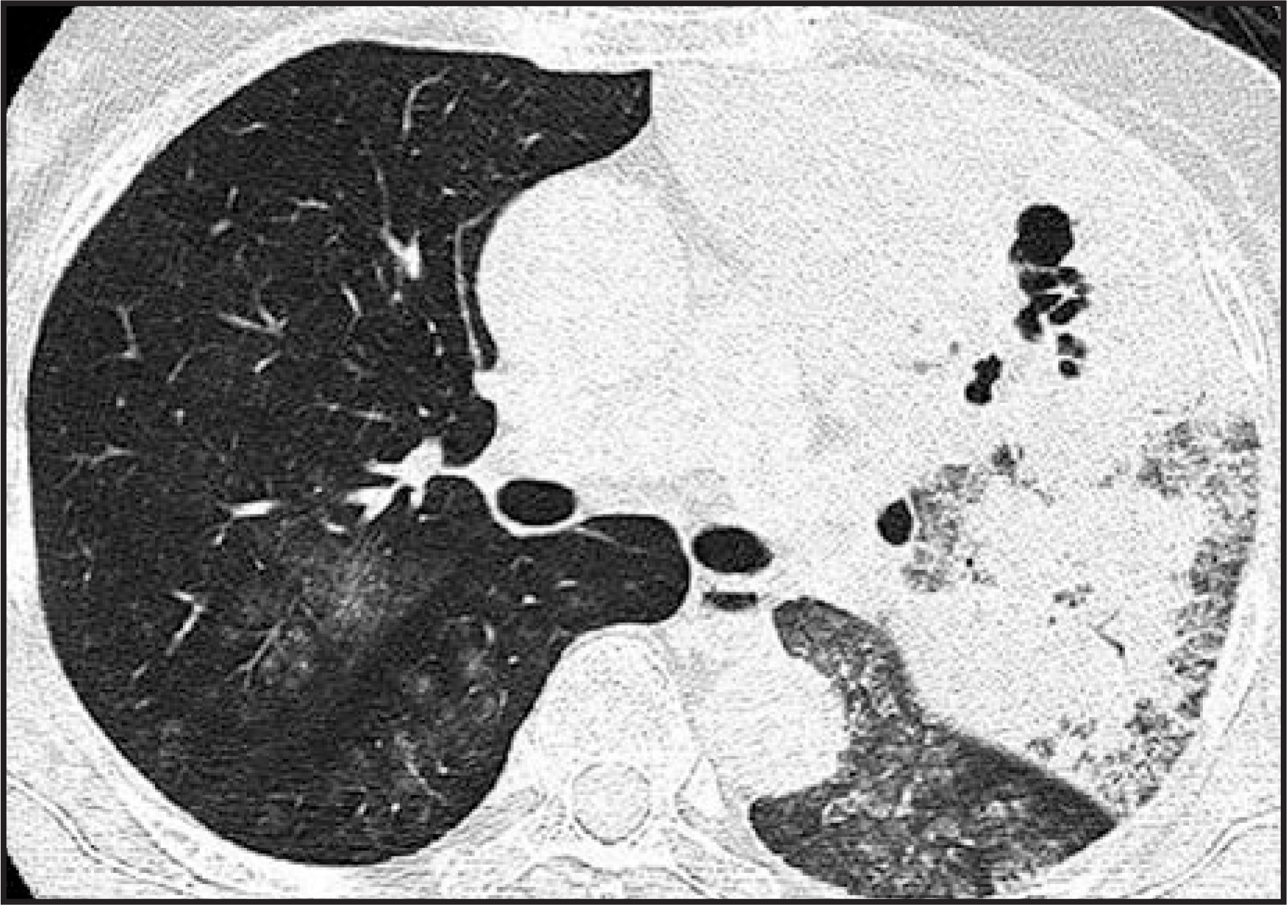FIGURE 13.