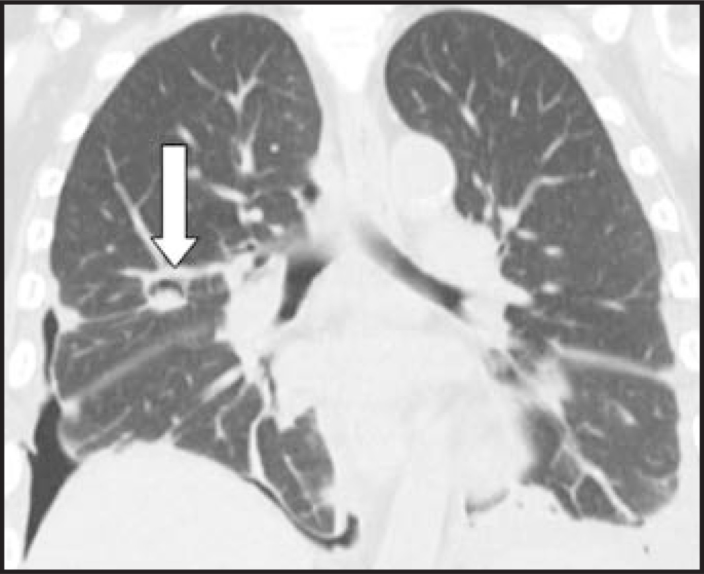 FIGURE 14.