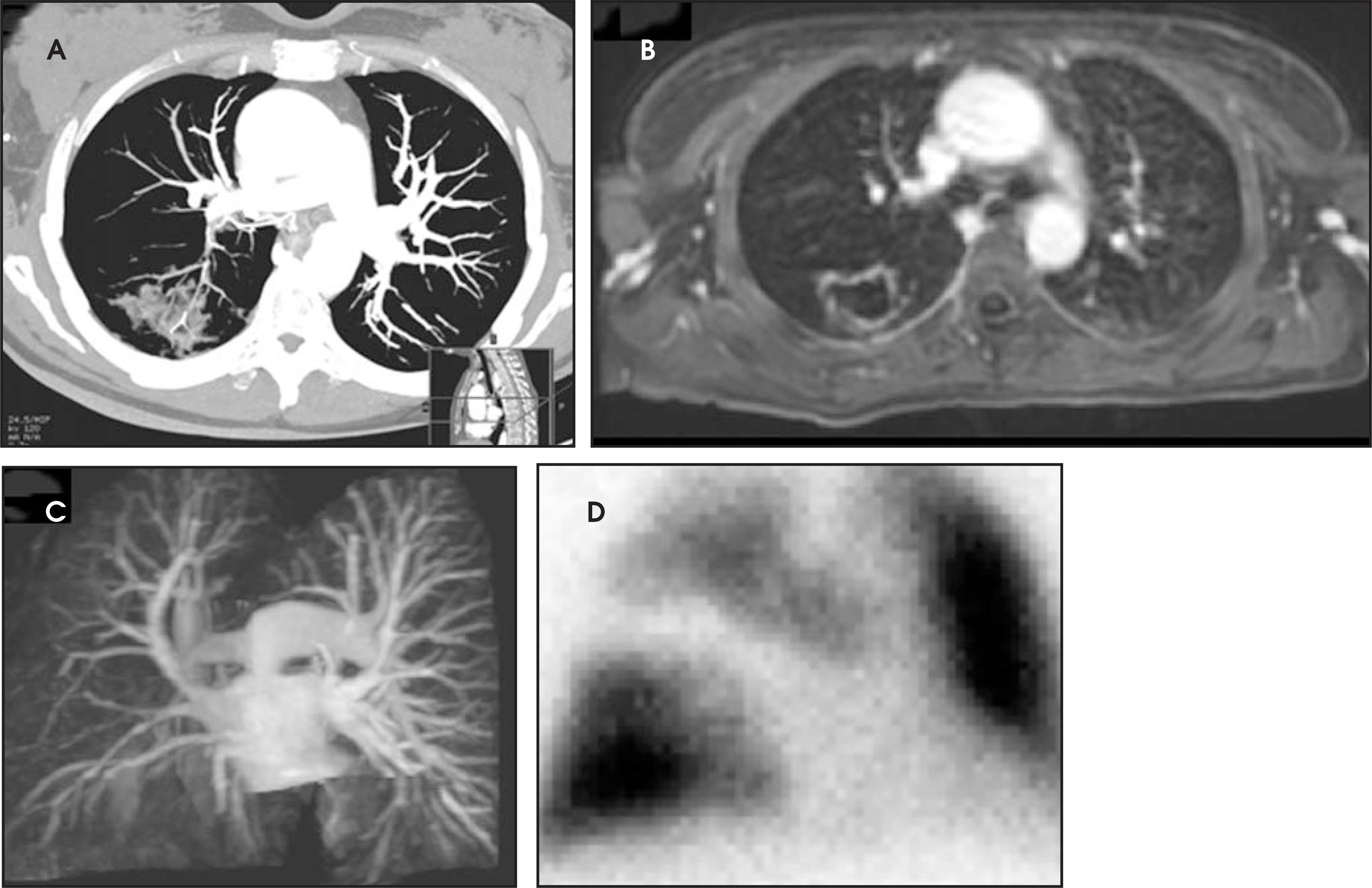 FIGURE 17.