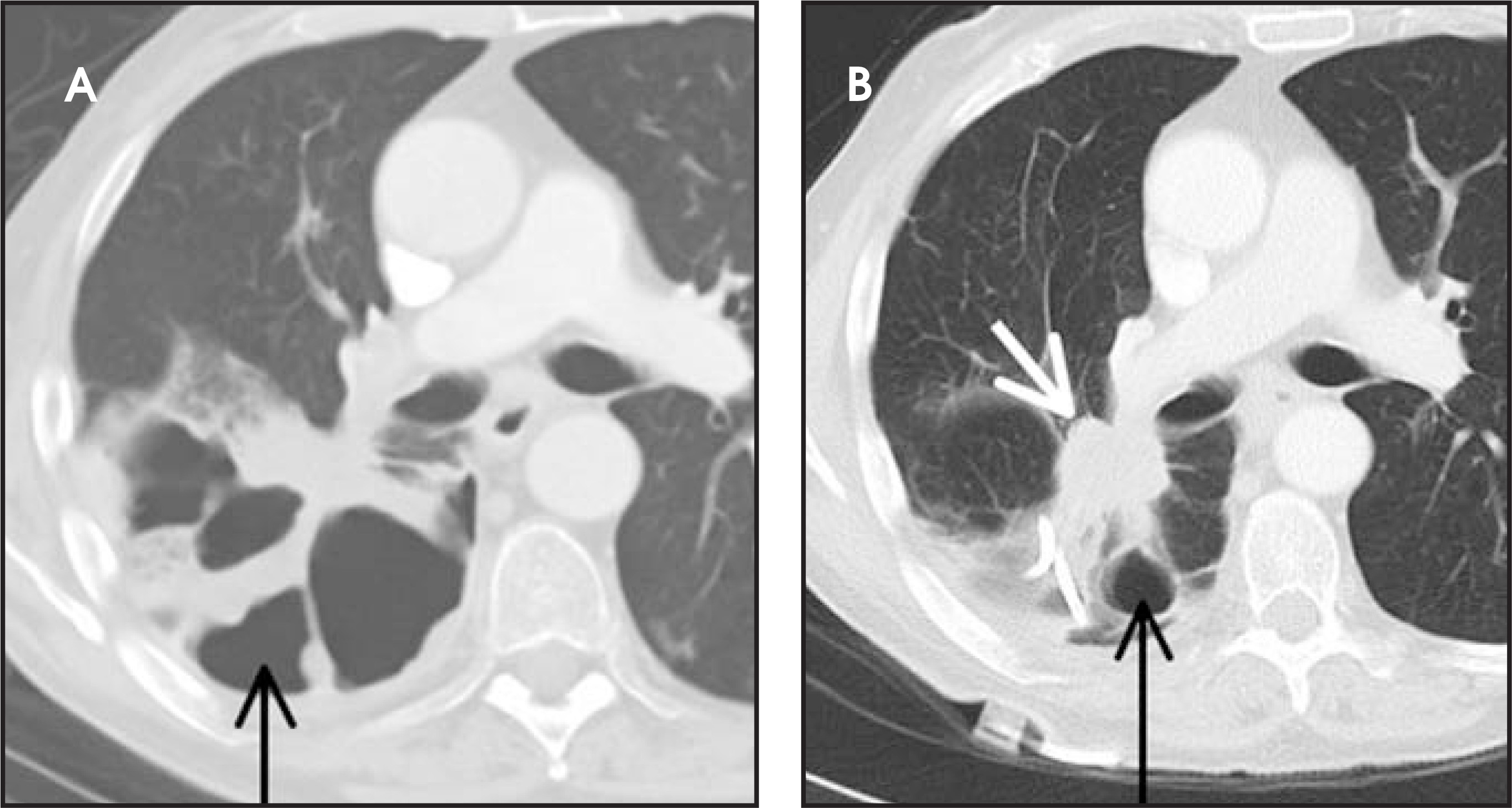 FIGURE 22.